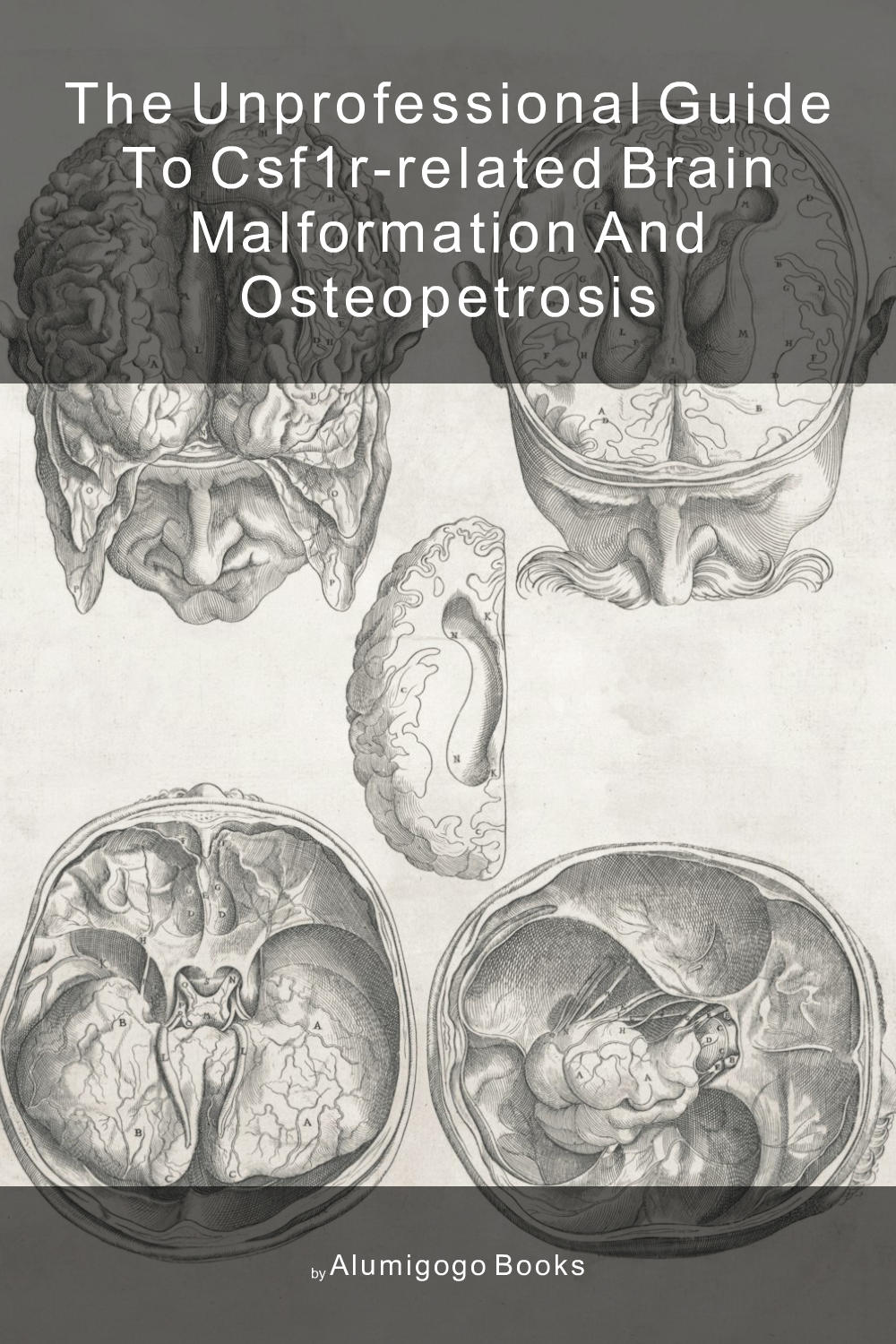 Cover of The Unprofessional Guide to CSF1R-related brain malformation and osteopetrosis