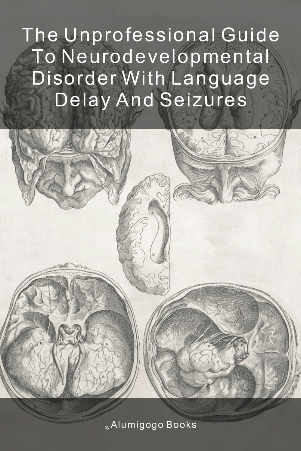 Cover of The Unprofessional Guide to neurodevelopmental disorder with language delay and seizures