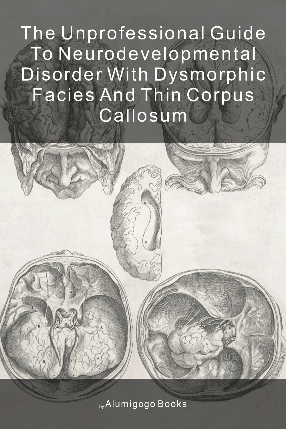 Cover of The Unprofessional Guide to neurodevelopmental disorder with dysmorphic facies and thin corpus callosum