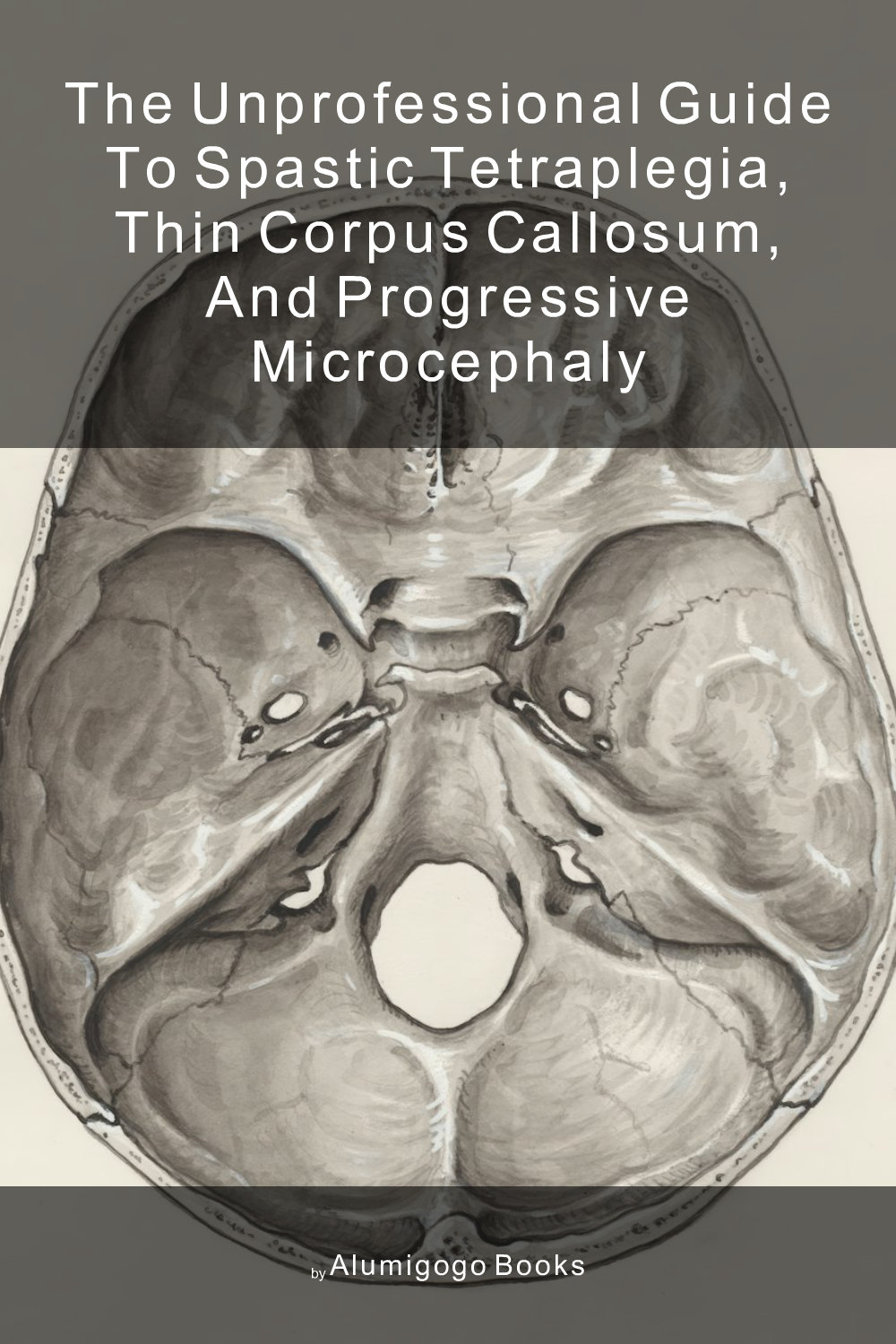 Cover of The Unprofessional Guide to spastic tetraplegia, thin corpus callosum, and progressive microcephaly