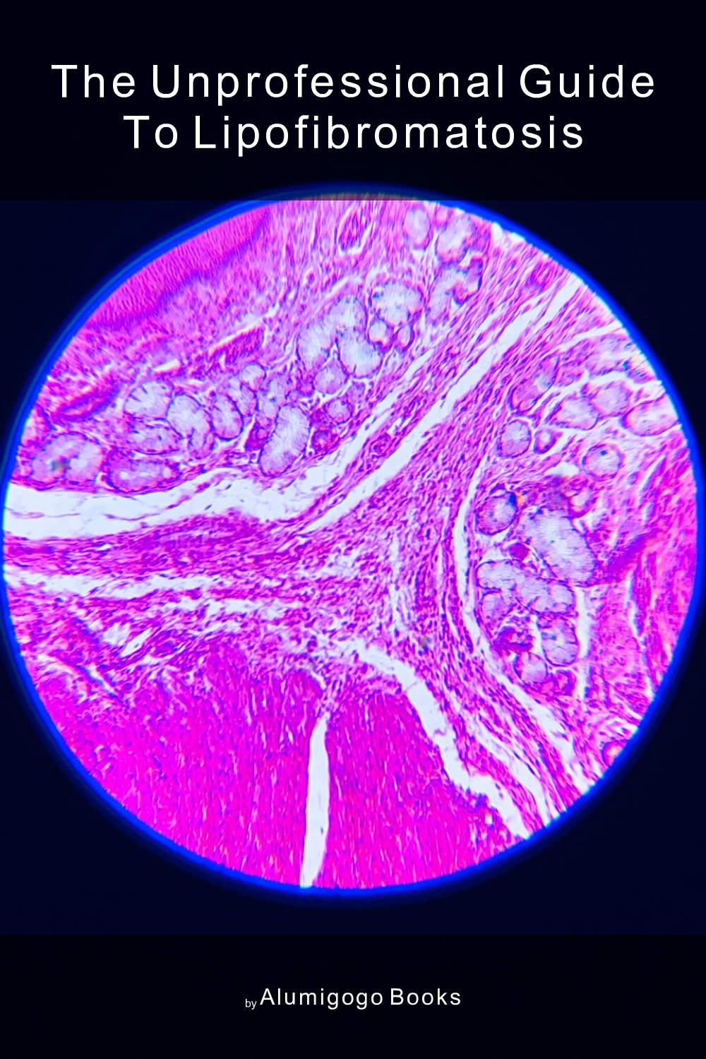 Cover of The Unprofessional Guide to lipofibromatosis