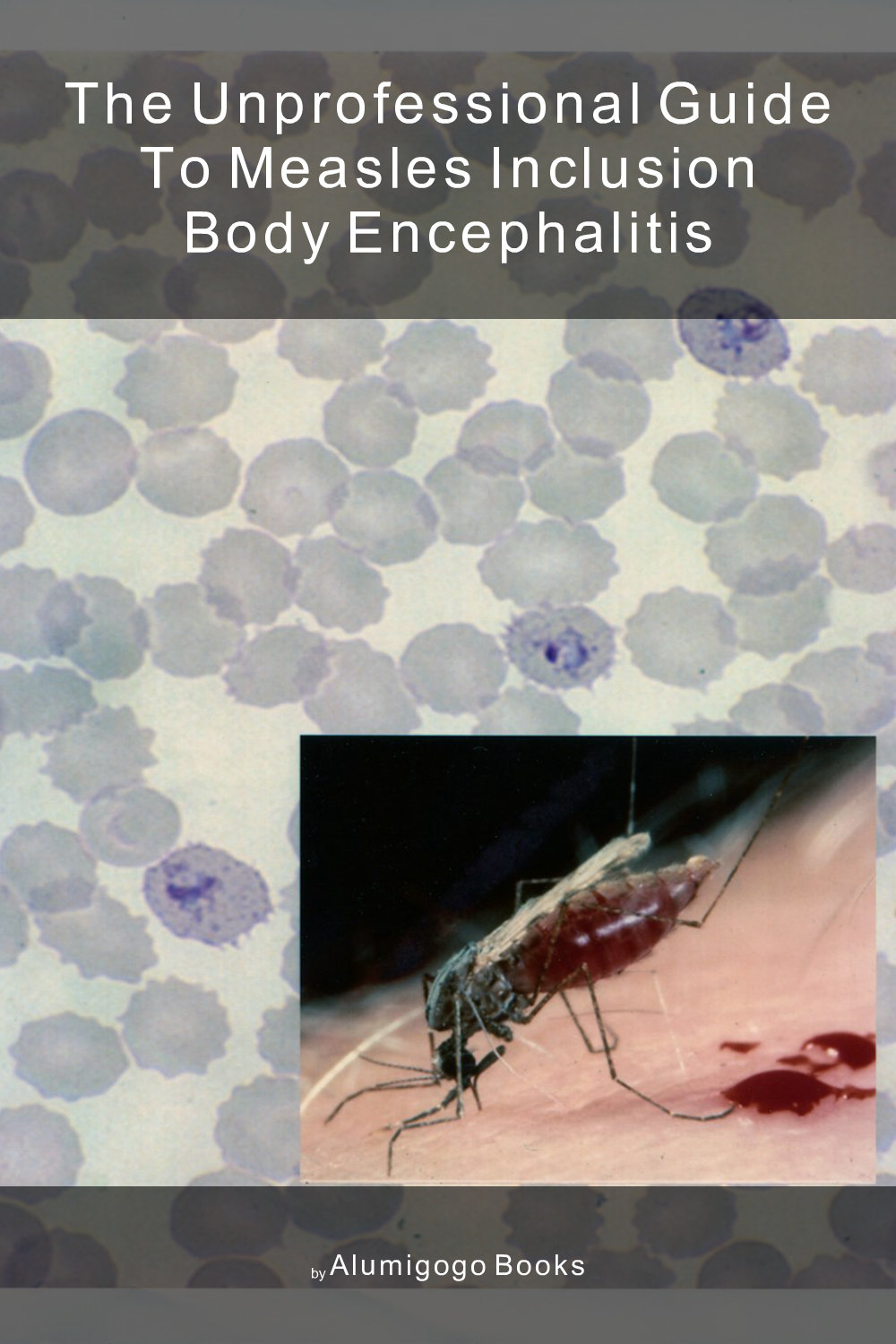 Cover of The Unprofessional Guide to measles inclusion body encephalitis