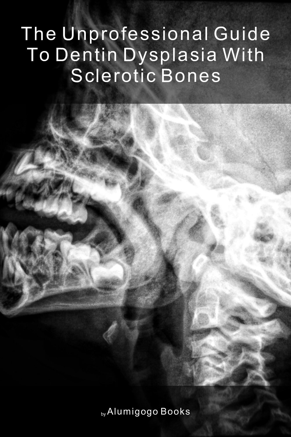 Cover of The Unprofessional Guide to dentin dysplasia with sclerotic bones