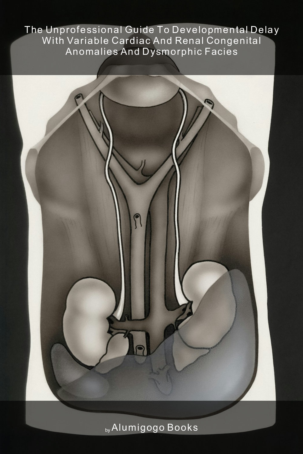 Cover of The Unprofessional Guide to developmental delay with variable cardiac and renal congenital anomalies and dysmorphic facies