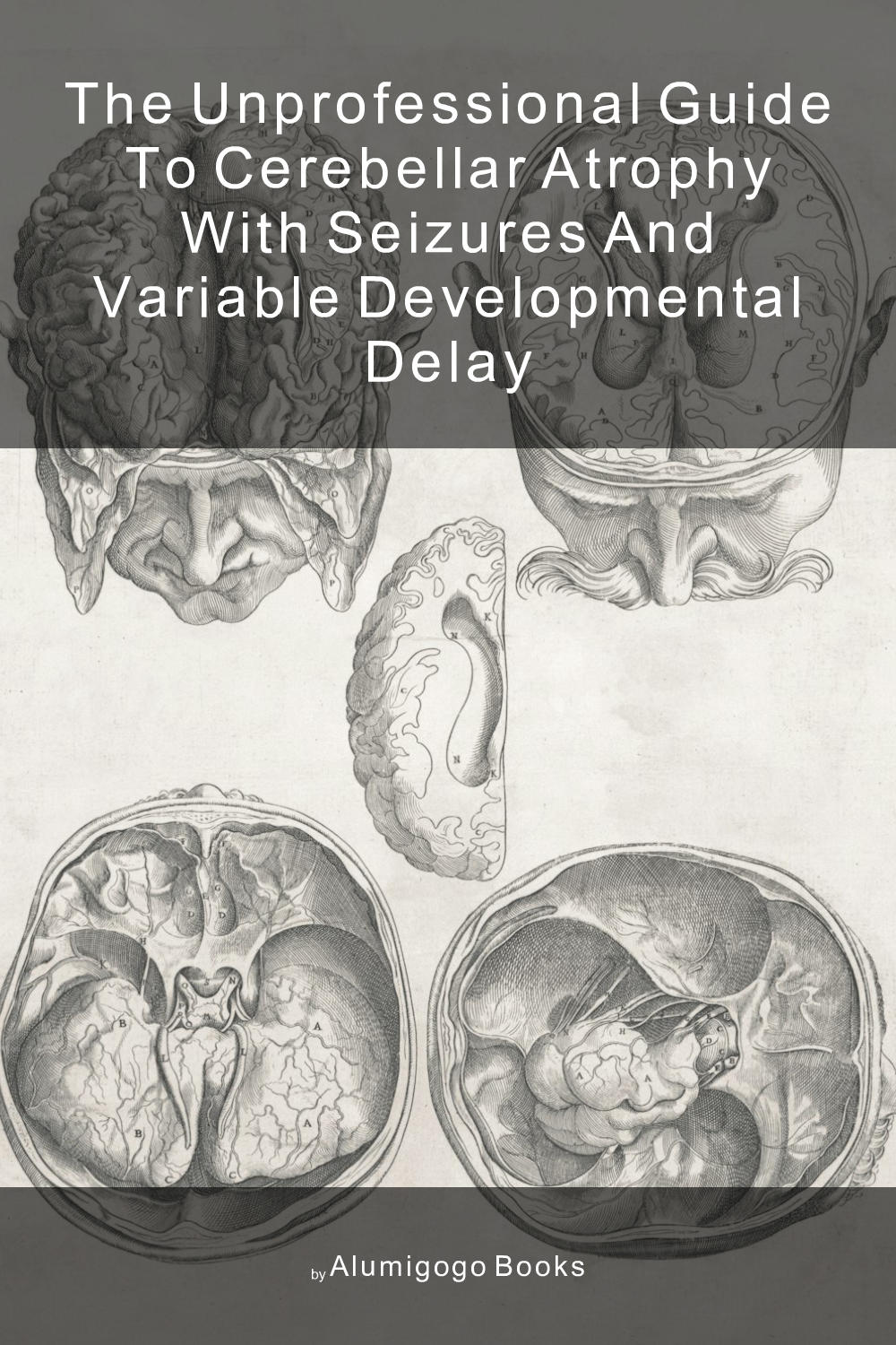 Cover of The Unprofessional Guide to cerebellar atrophy with seizures and variable developmental delay