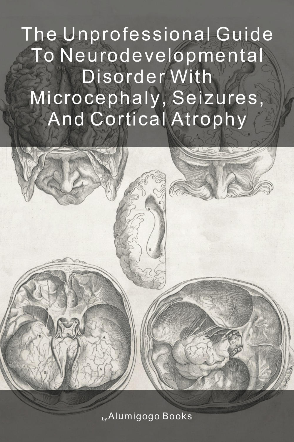 Cover of The Unprofessional Guide to neurodevelopmental disorder with microcephaly, seizures, and cortical atrophy