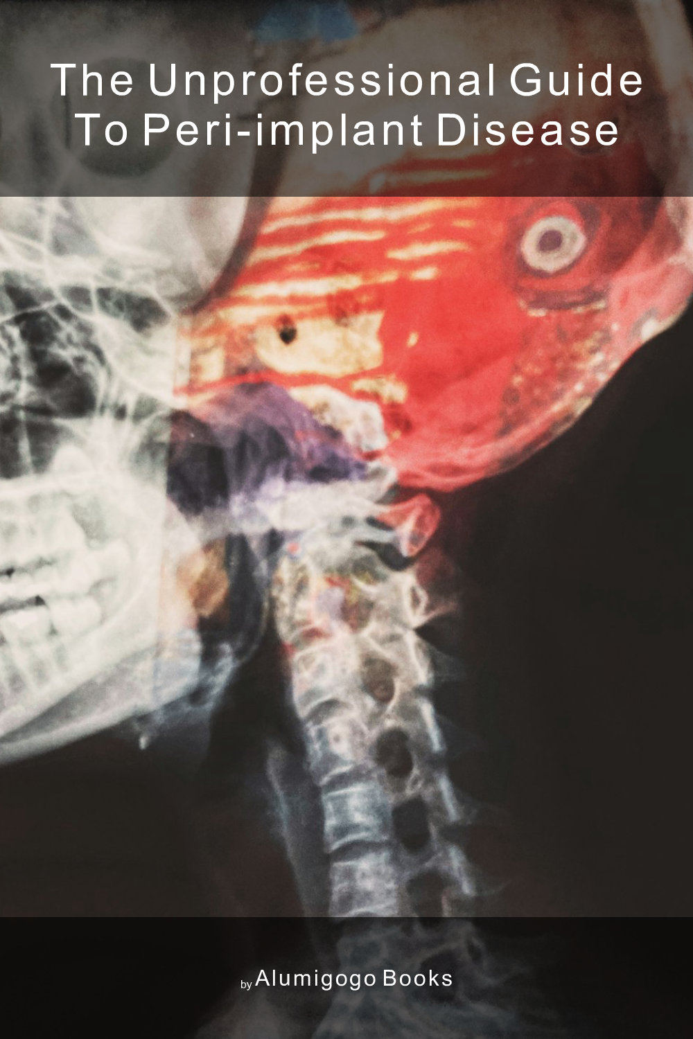 Cover of The Unprofessional Guide to peri-implant disease