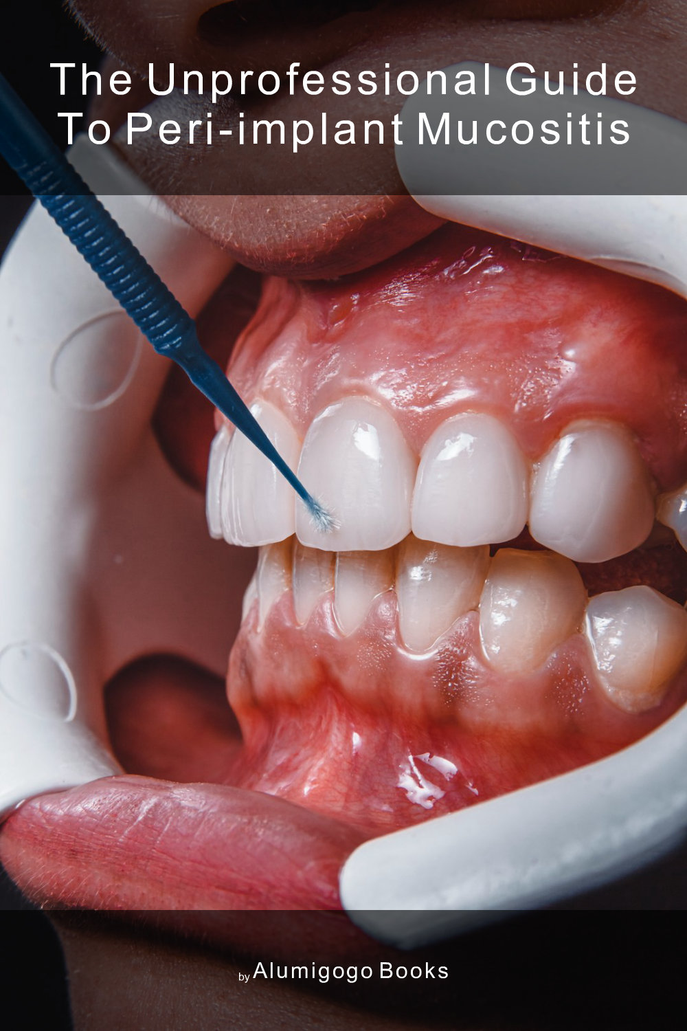 Cover of The Unprofessional Guide to peri-implant mucositis