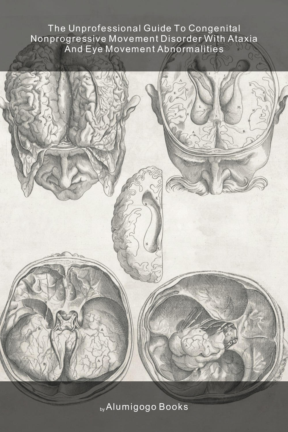 Cover of The Unprofessional Guide to congenital nonprogressive movement disorder with ataxia and eye movement abnormalities