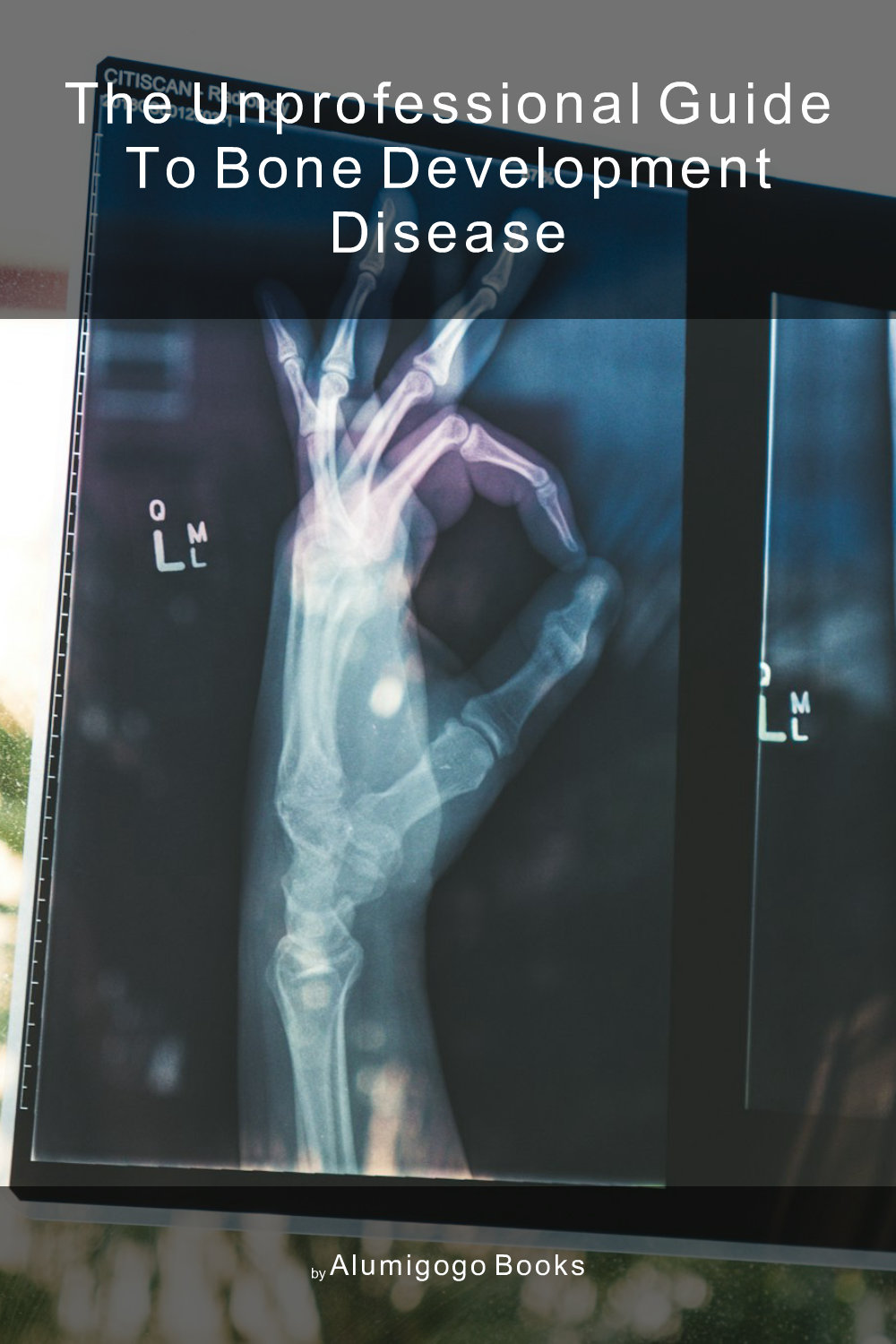 Cover of The Unprofessional Guide to bone development disease