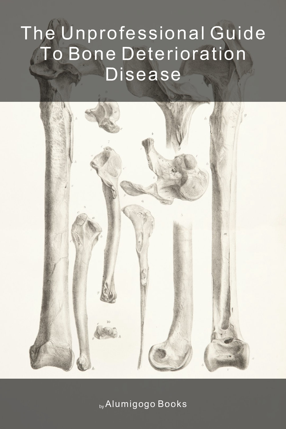 Cover of The Unprofessional Guide to bone deterioration disease