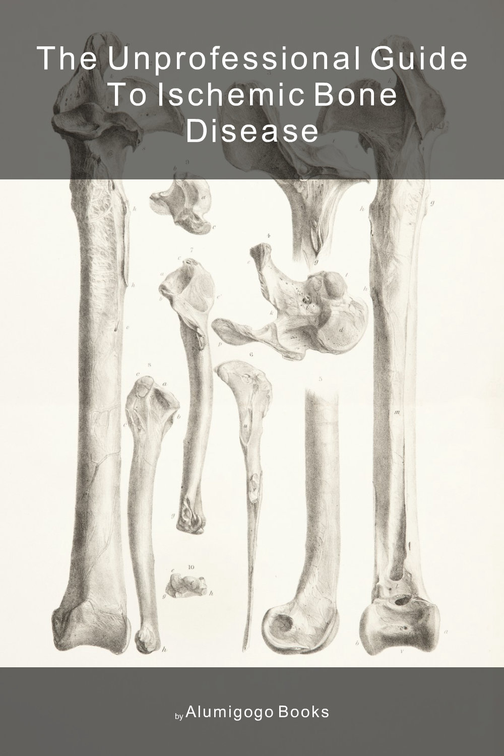 Cover of The Unprofessional Guide to ischemic bone disease