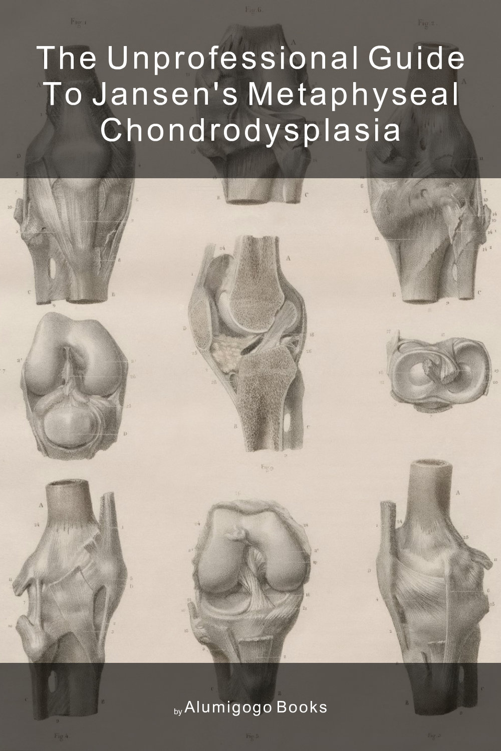 Cover of The Unprofessional Guide to Jansen's metaphyseal chondrodysplasia