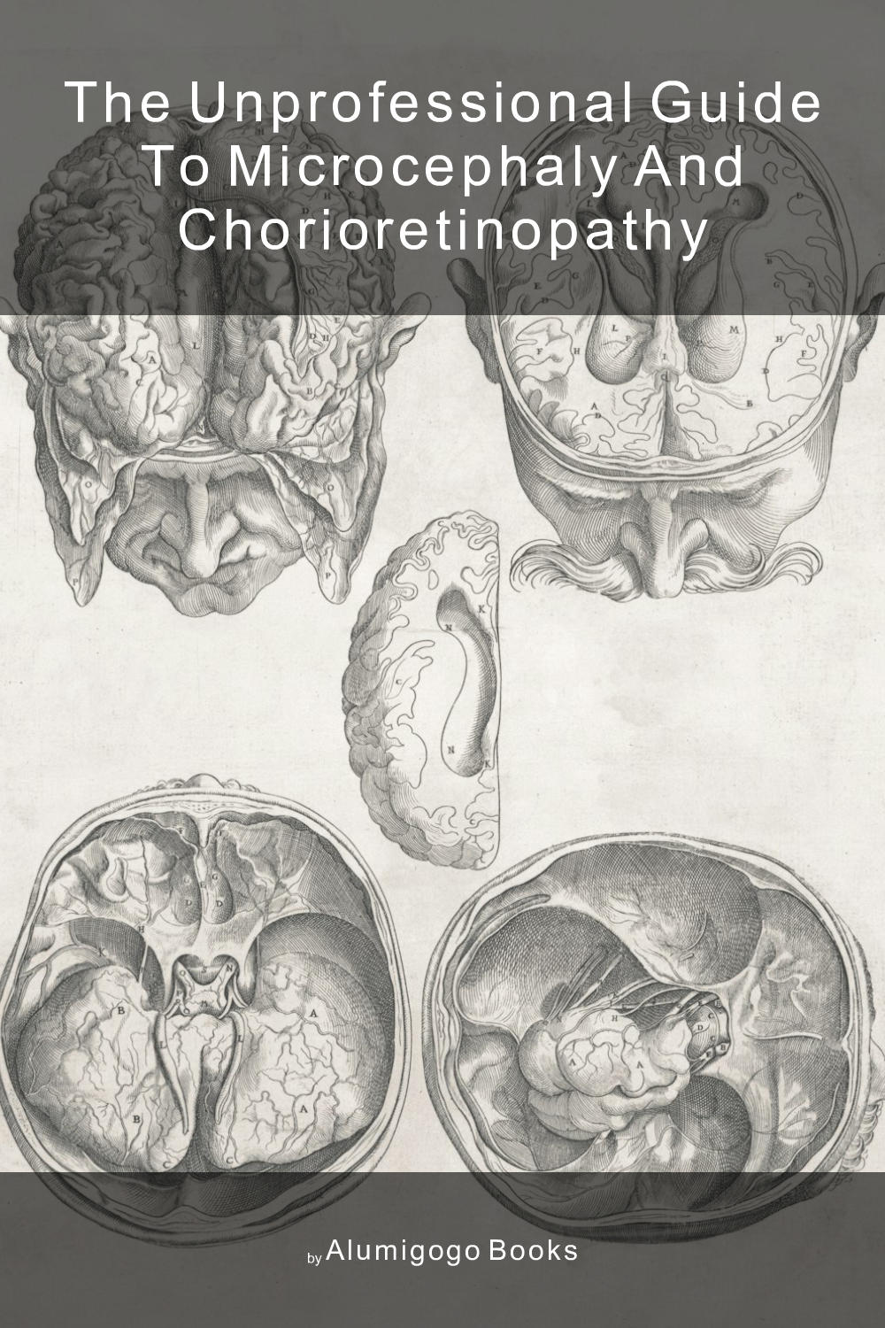 Cover of The Unprofessional Guide to microcephaly and chorioretinopathy