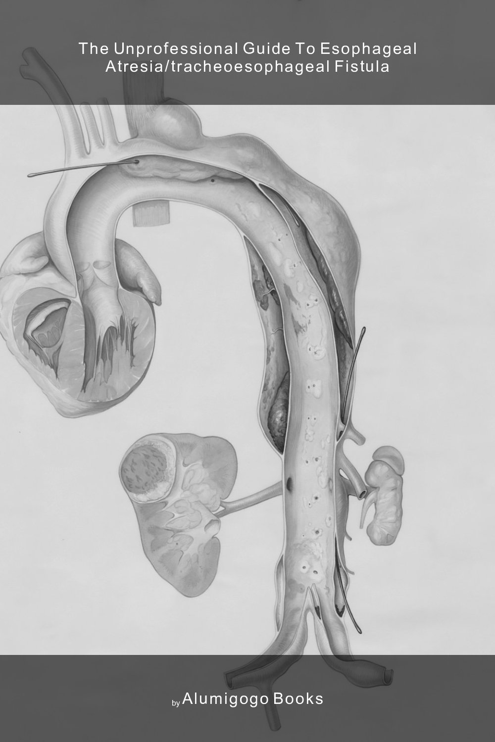 Cover of The Unprofessional Guide to esophageal atresia/tracheoesophageal fistula