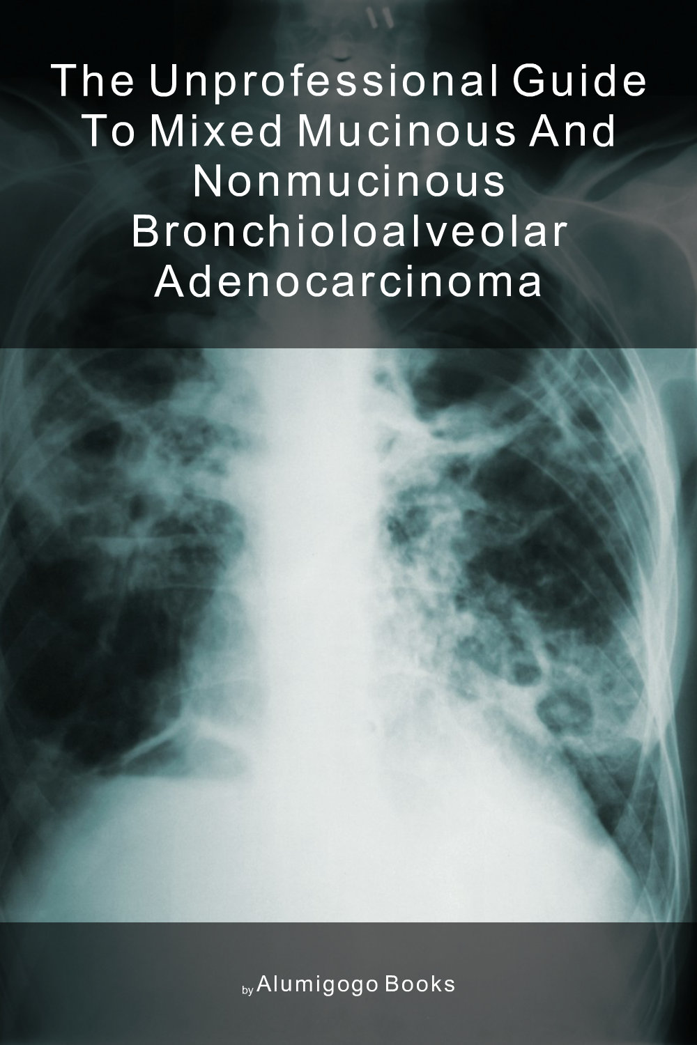 Cover of The Unprofessional Guide to mixed mucinous and nonmucinous bronchioloalveolar adenocarcinoma