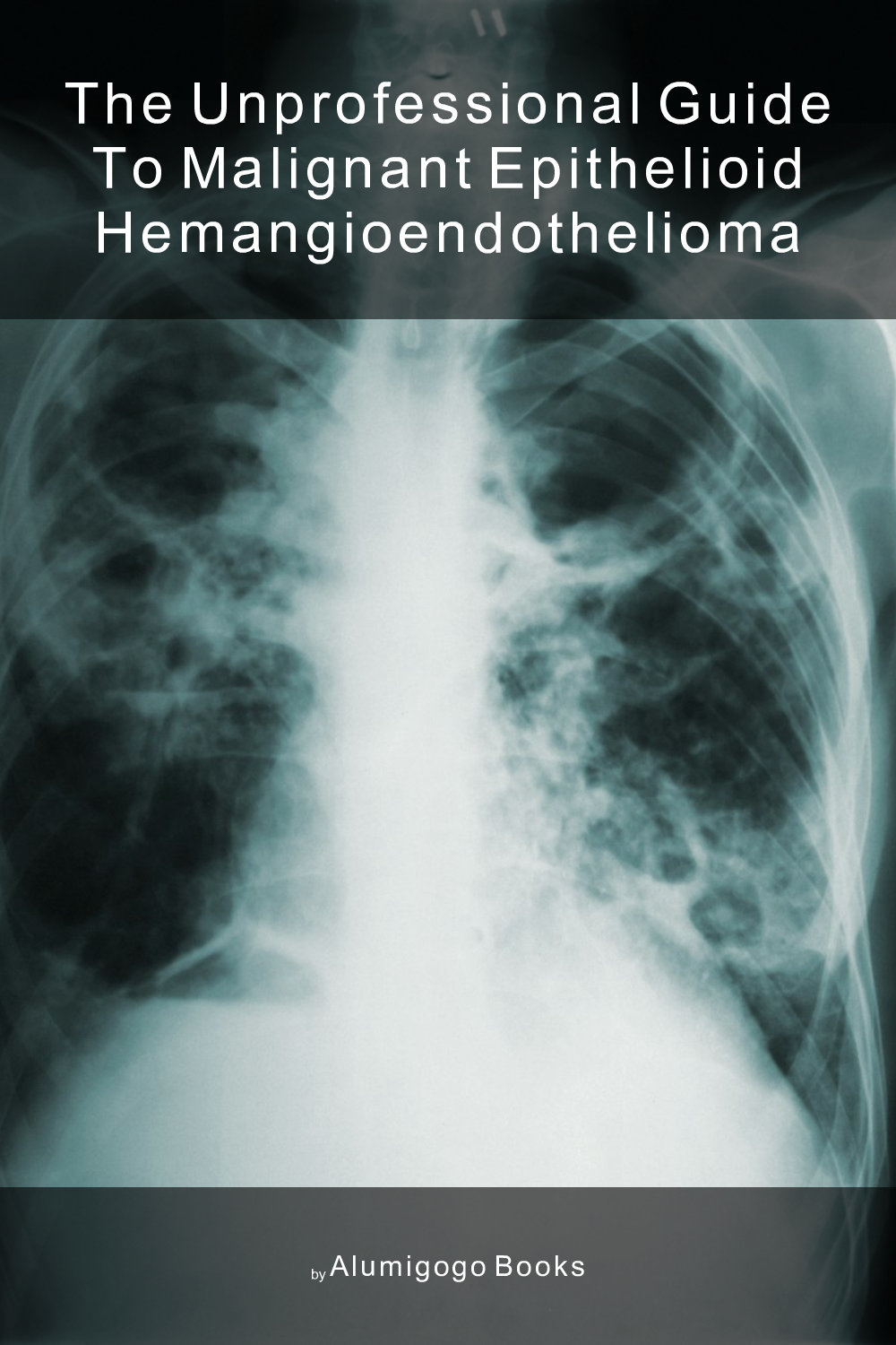 Cover of The Unprofessional Guide to malignant epithelioid hemangioendothelioma