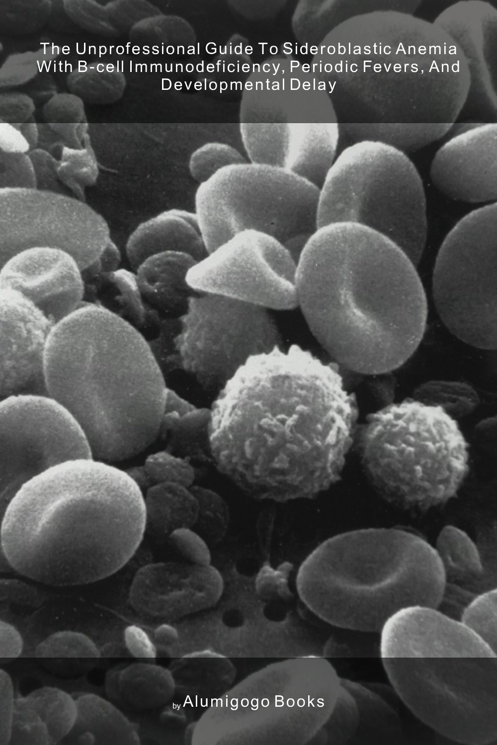 Cover of The Unprofessional Guide to sideroblastic anemia with B-cell immunodeficiency, periodic fevers, and developmental delay