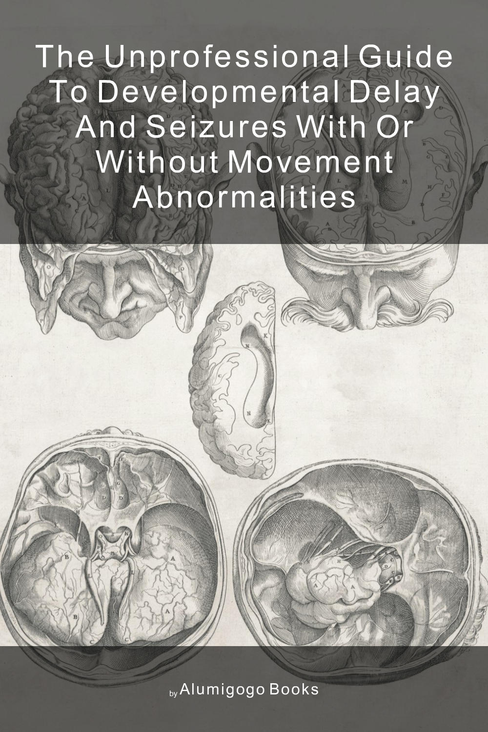 Cover of The Unprofessional Guide to developmental delay and seizures with or without movement abnormalities