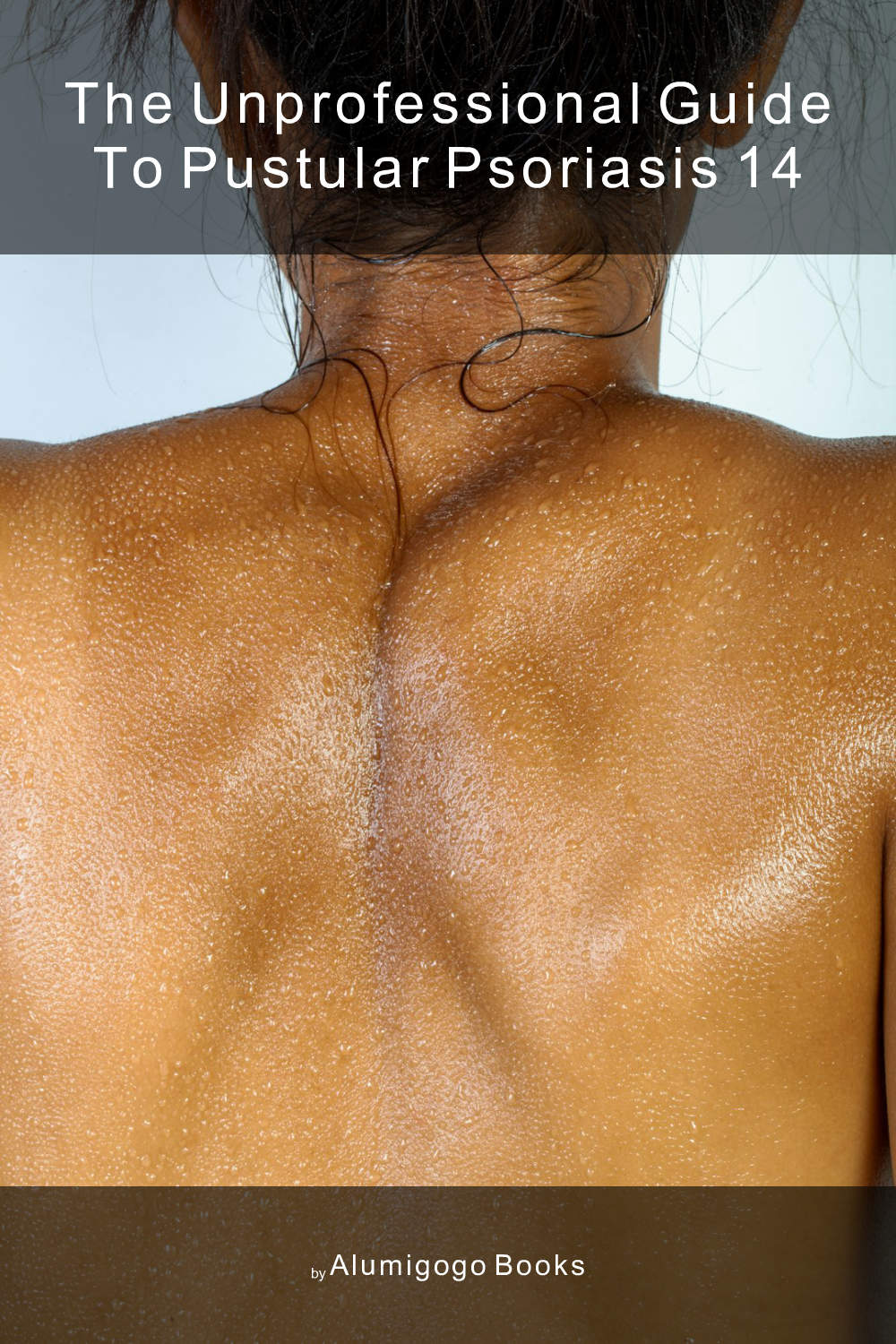 Cover of The Unprofessional Guide to pustular psoriasis 14