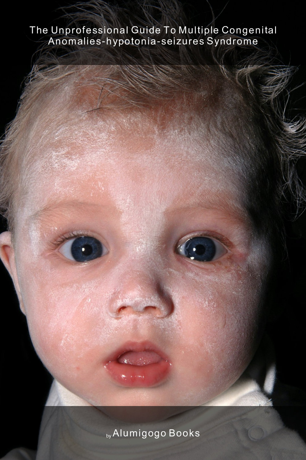 Cover of The Unprofessional Guide to multiple congenital anomalies-hypotonia-seizures syndrome