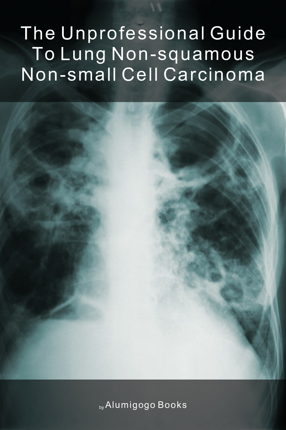 Cover of The Unprofessional Guide to lung non-squamous non-small cell carcinoma