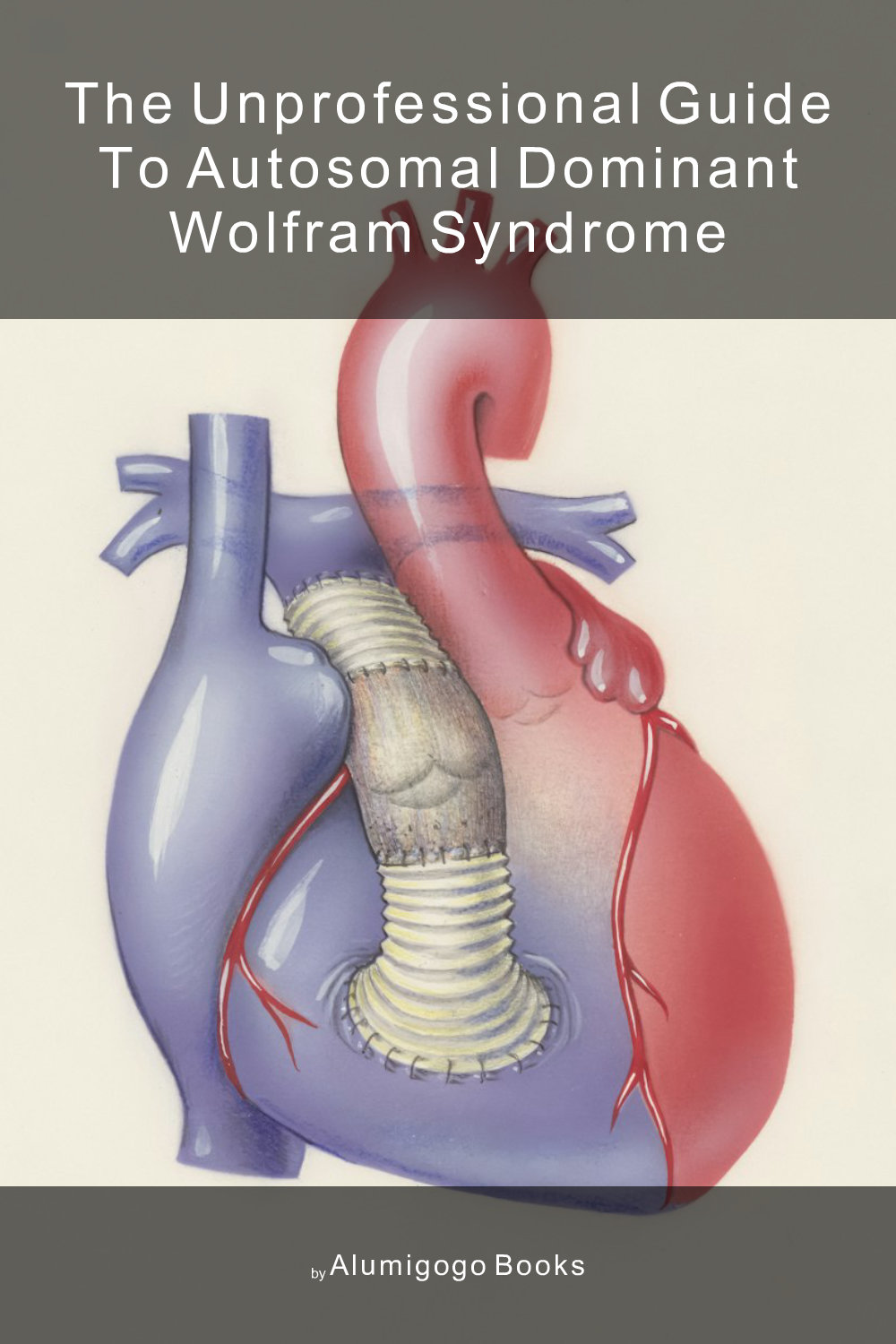 Cover of The Unprofessional Guide to autosomal dominant Wolfram syndrome