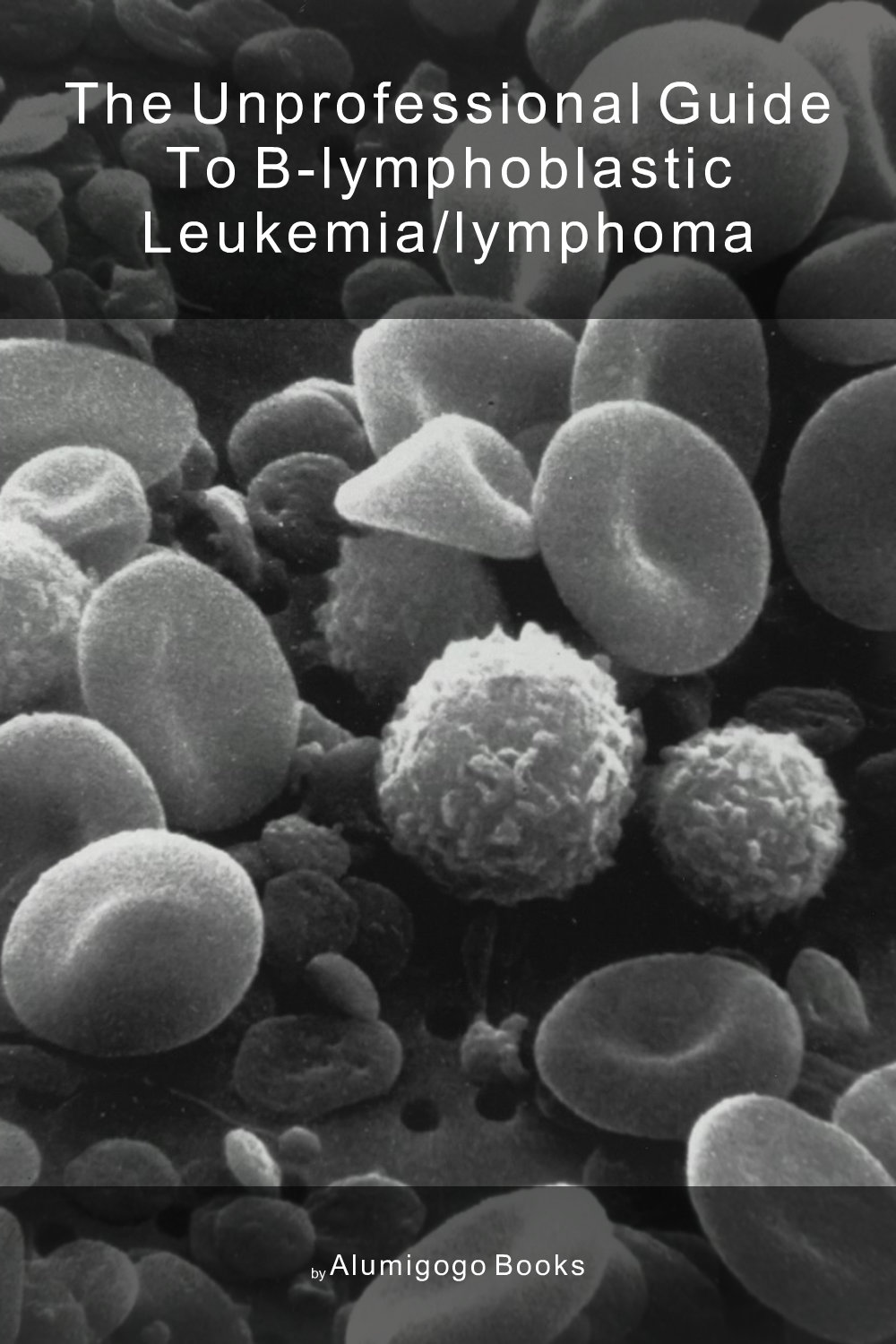 Cover of The Unprofessional Guide to B-lymphoblastic leukemia/lymphoma