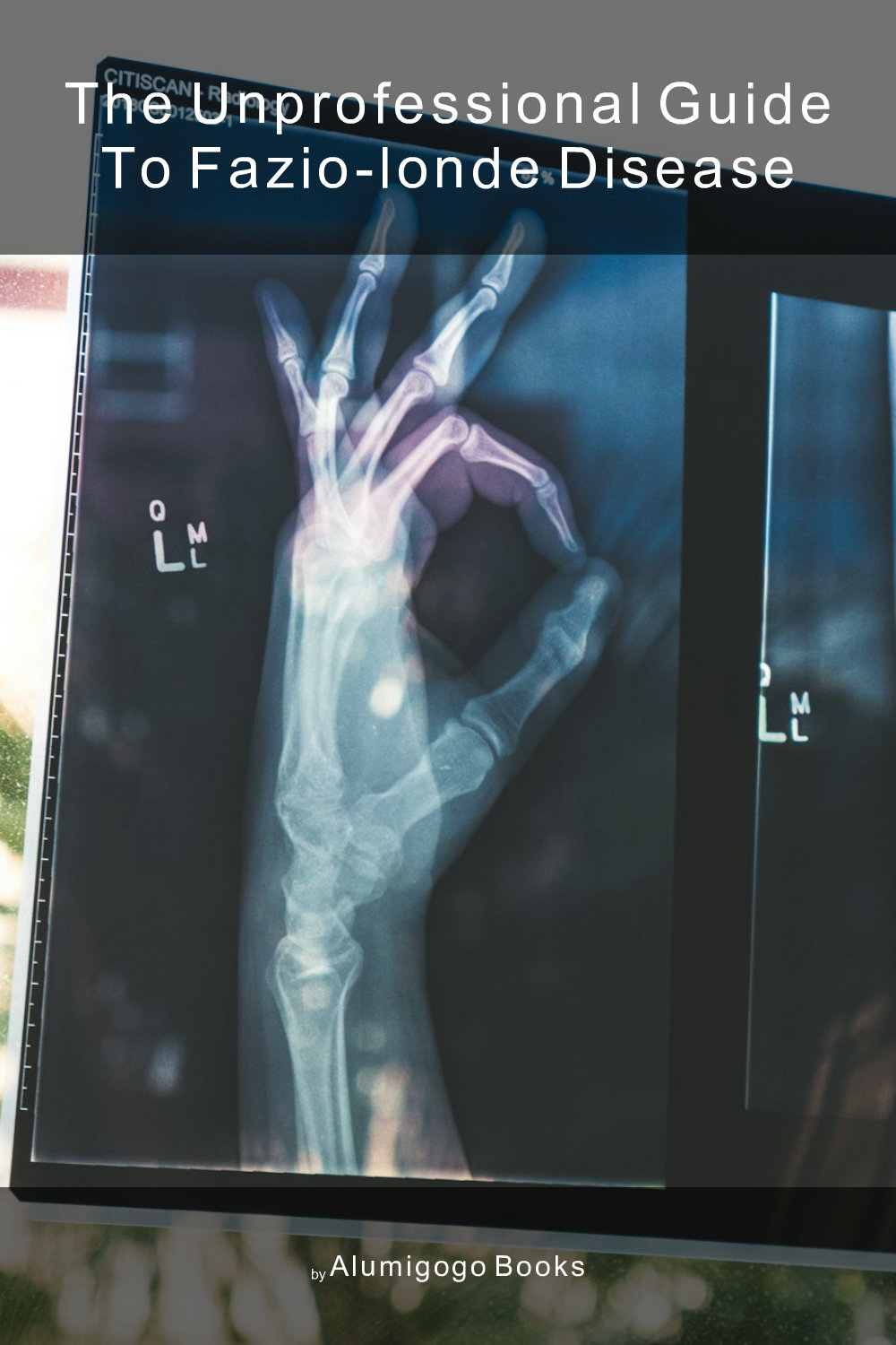 Cover of The Unprofessional Guide to Fazio-Londe disease