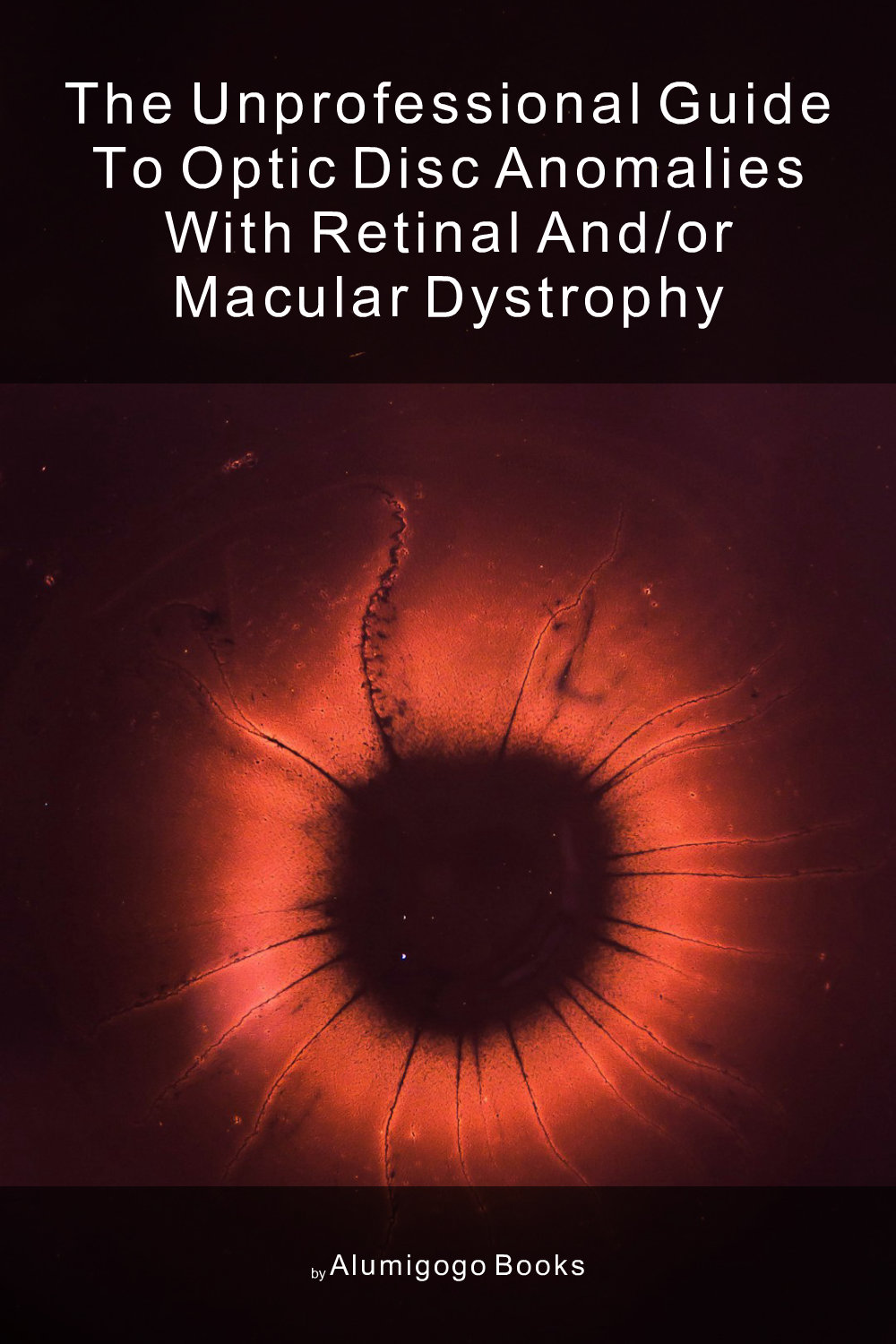 Cover of The Unprofessional Guide to optic disc anomalies with retinal and/or macular dystrophy