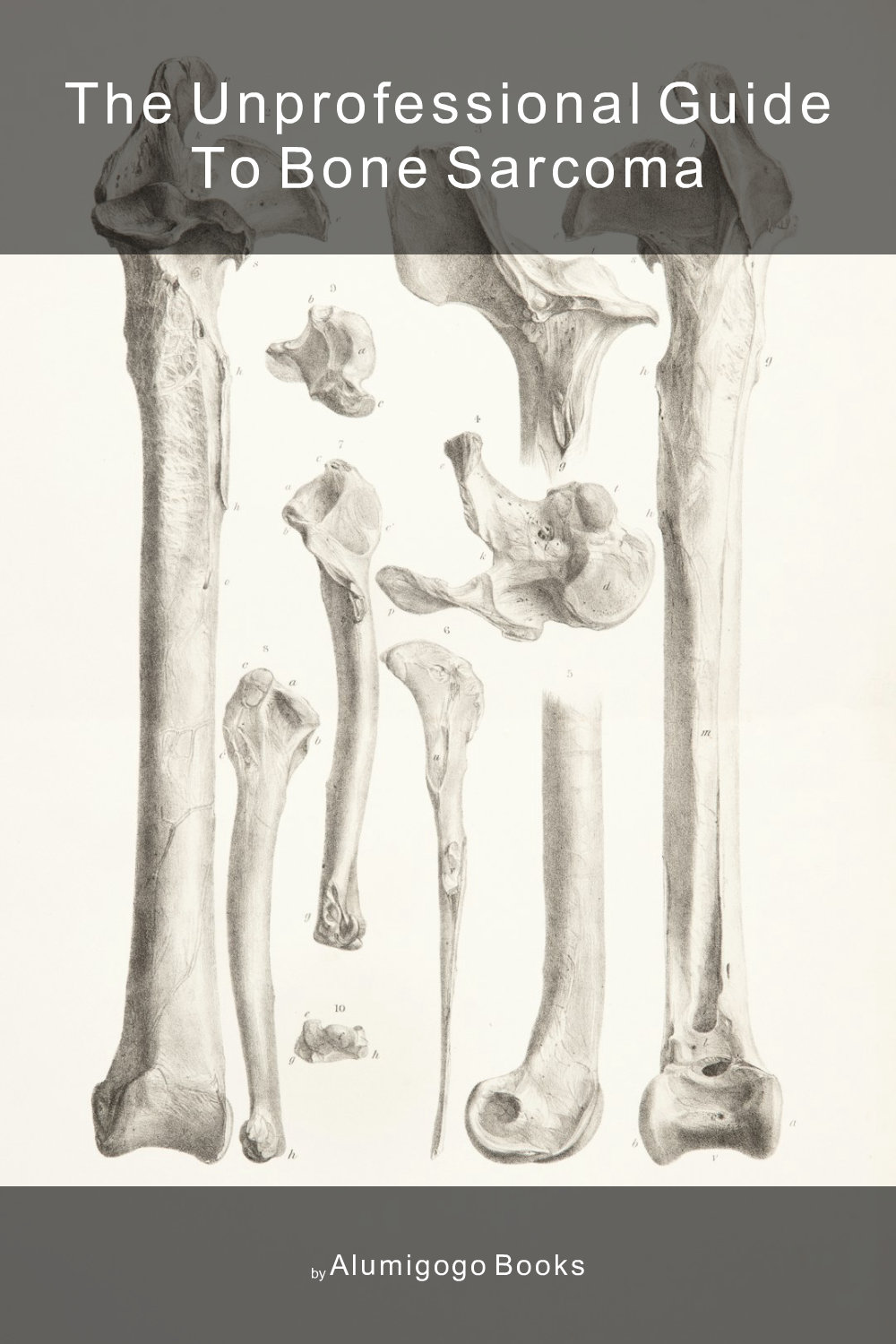 Cover of The Unprofessional Guide to bone sarcoma