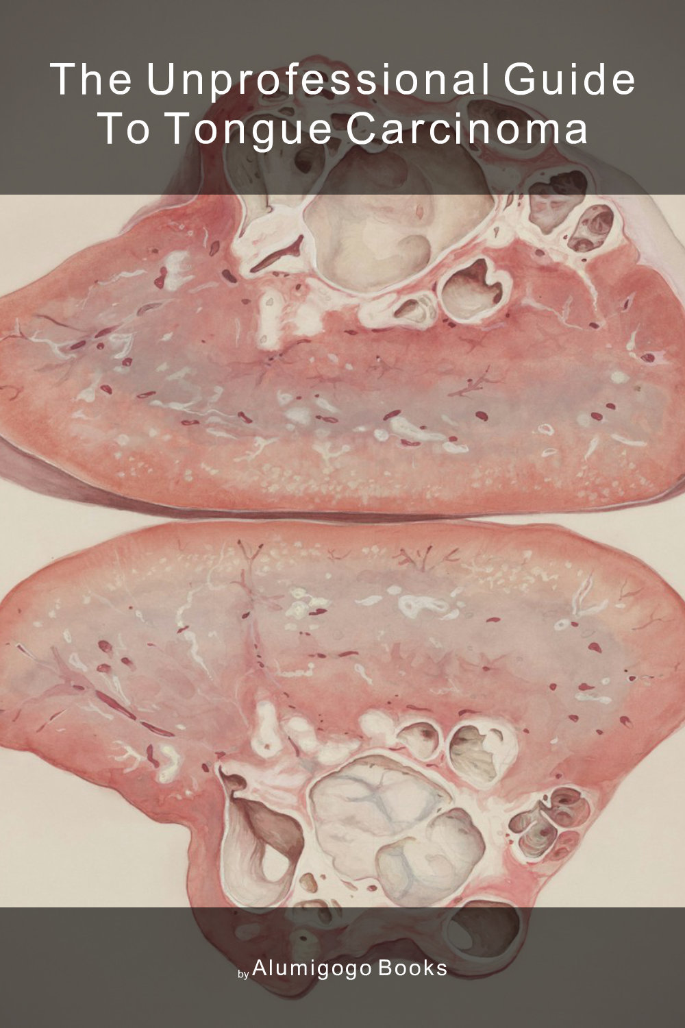Cover of The Unprofessional Guide to tongue carcinoma
