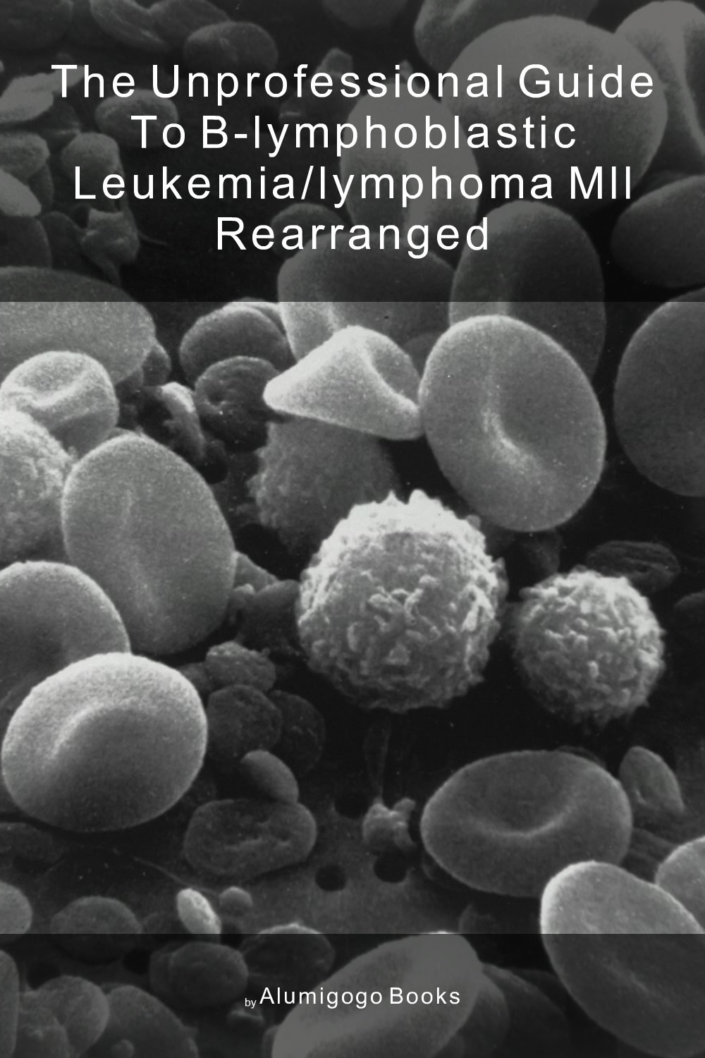 Cover of The Unprofessional Guide to B-lymphoblastic leukemia/lymphoma MLL rearranged
