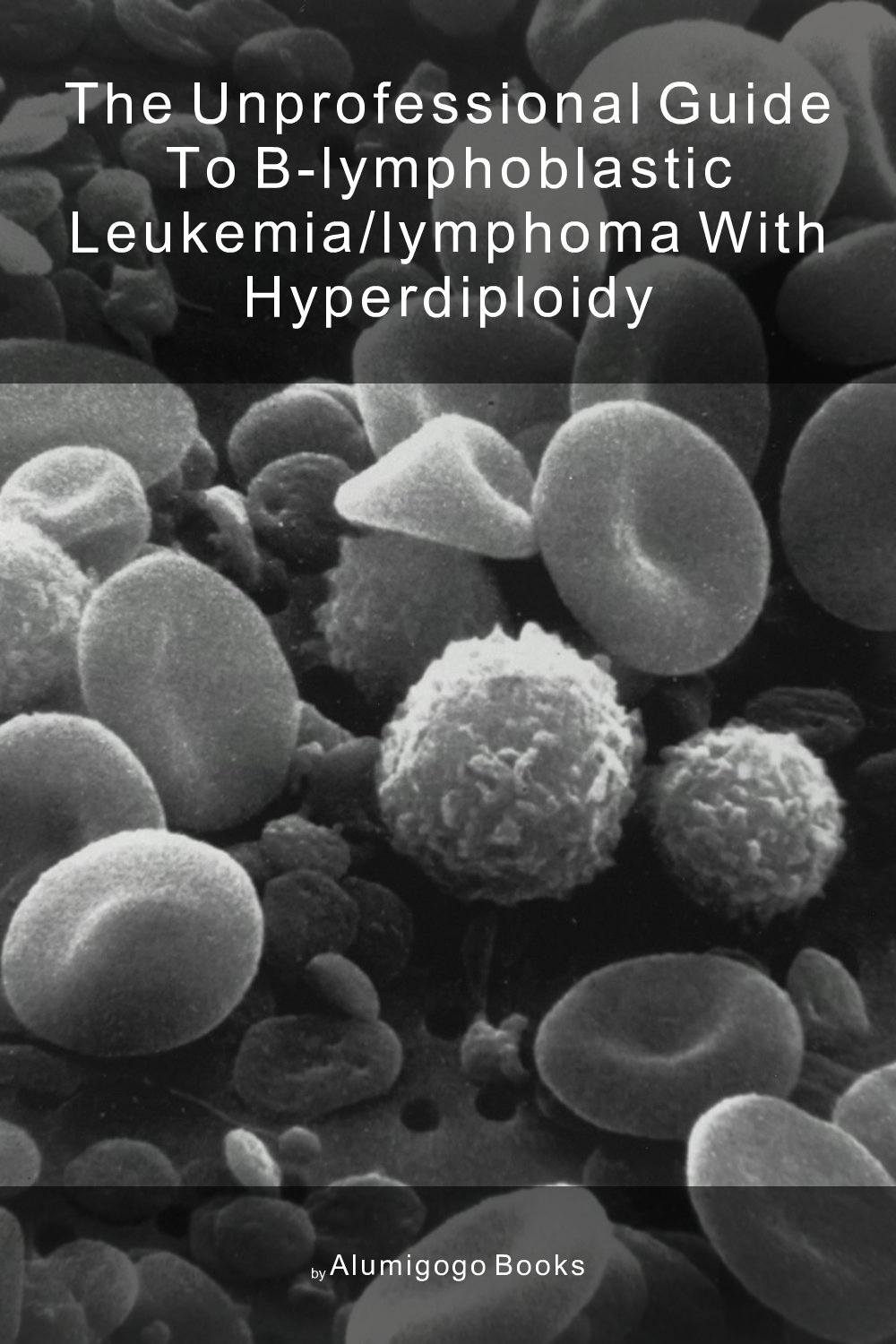 Cover of The Unprofessional Guide to B-lymphoblastic leukemia/lymphoma with hyperdiploidy