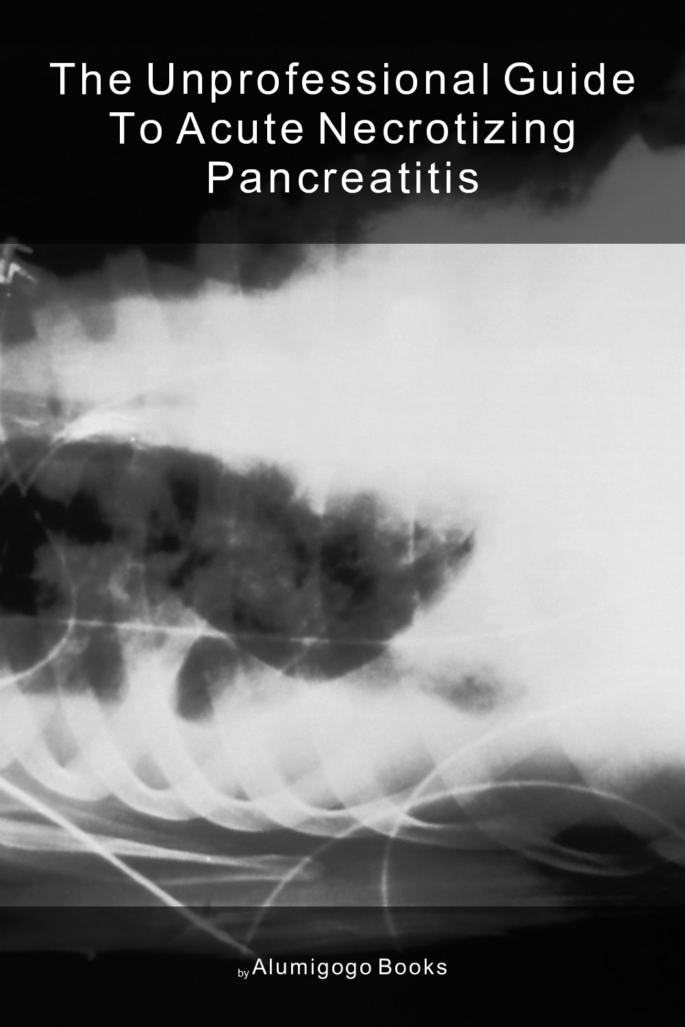 Cover of The Unprofessional Guide to acute necrotizing pancreatitis