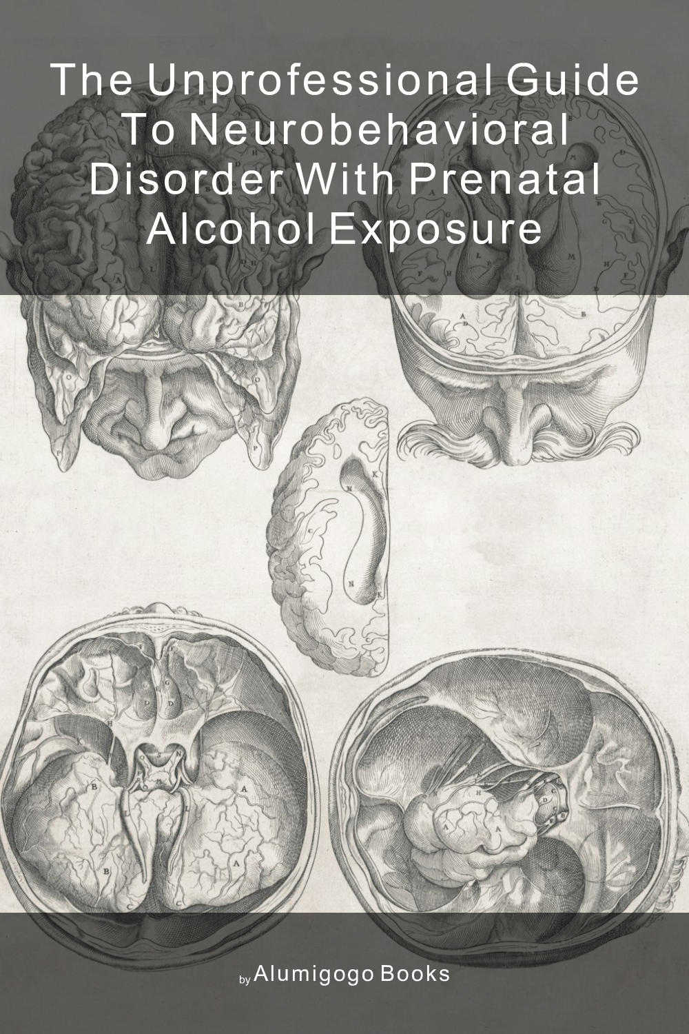 Cover of The Unprofessional Guide to neurobehavioral disorder with prenatal alcohol exposure