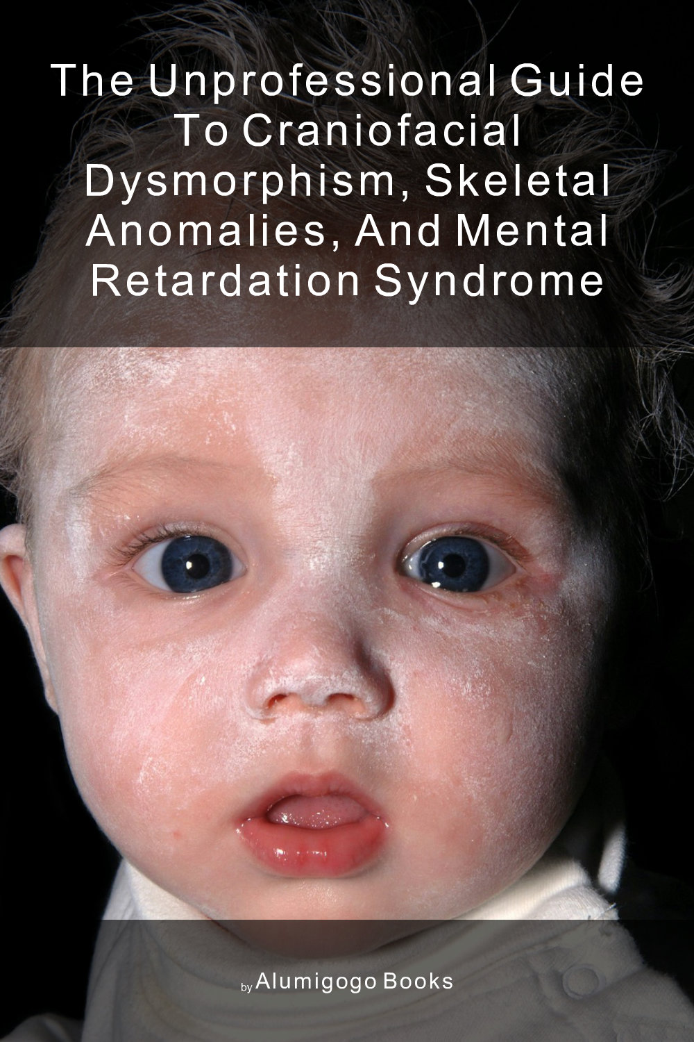 Cover of The Unprofessional Guide to craniofacial dysmorphism, skeletal anomalies, and mental retardation syndrome