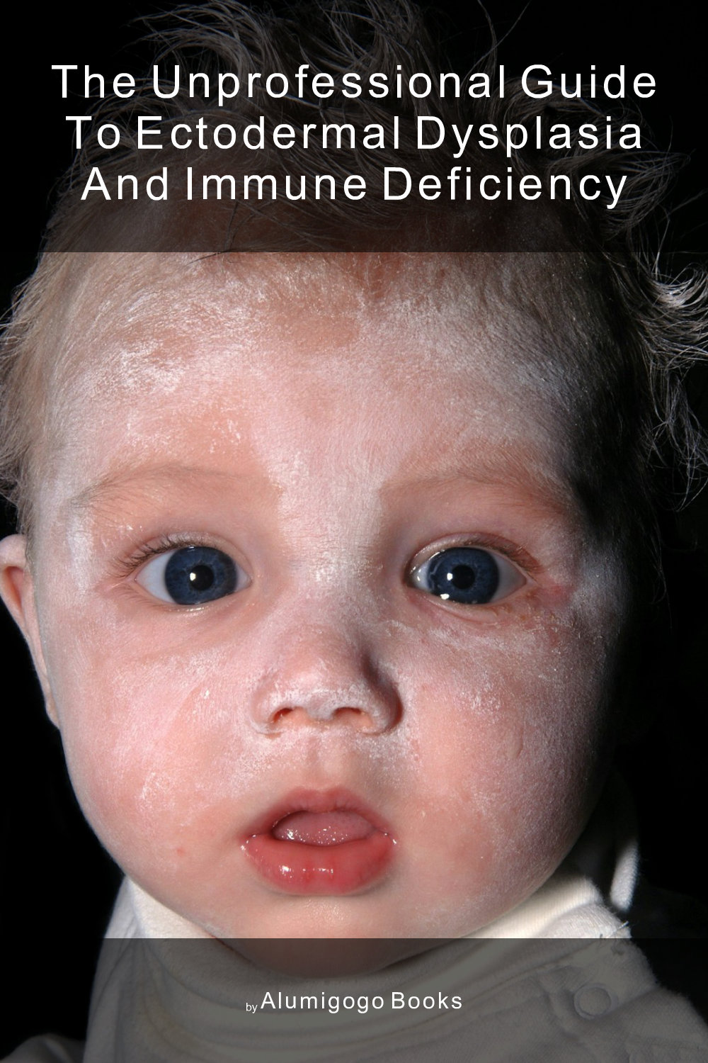 Cover of The Unprofessional Guide to ectodermal dysplasia and immune deficiency