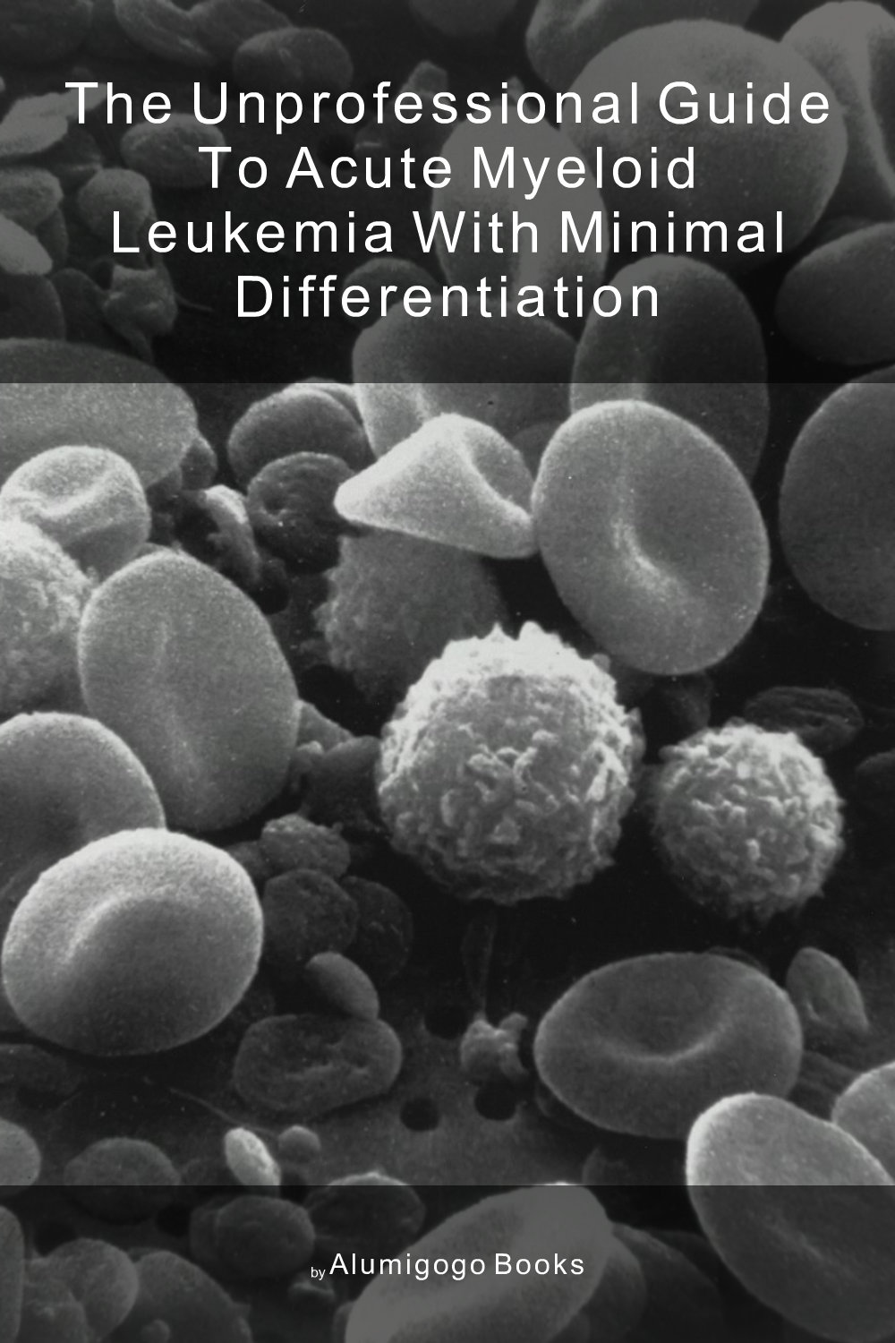 Cover of The Unprofessional Guide to acute myeloid leukemia with minimal differentiation
