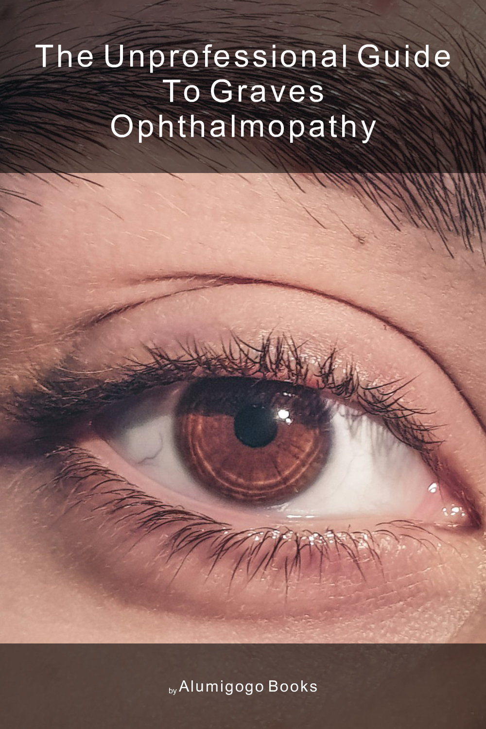 Cover of The Unprofessional Guide to Graves ophthalmopathy