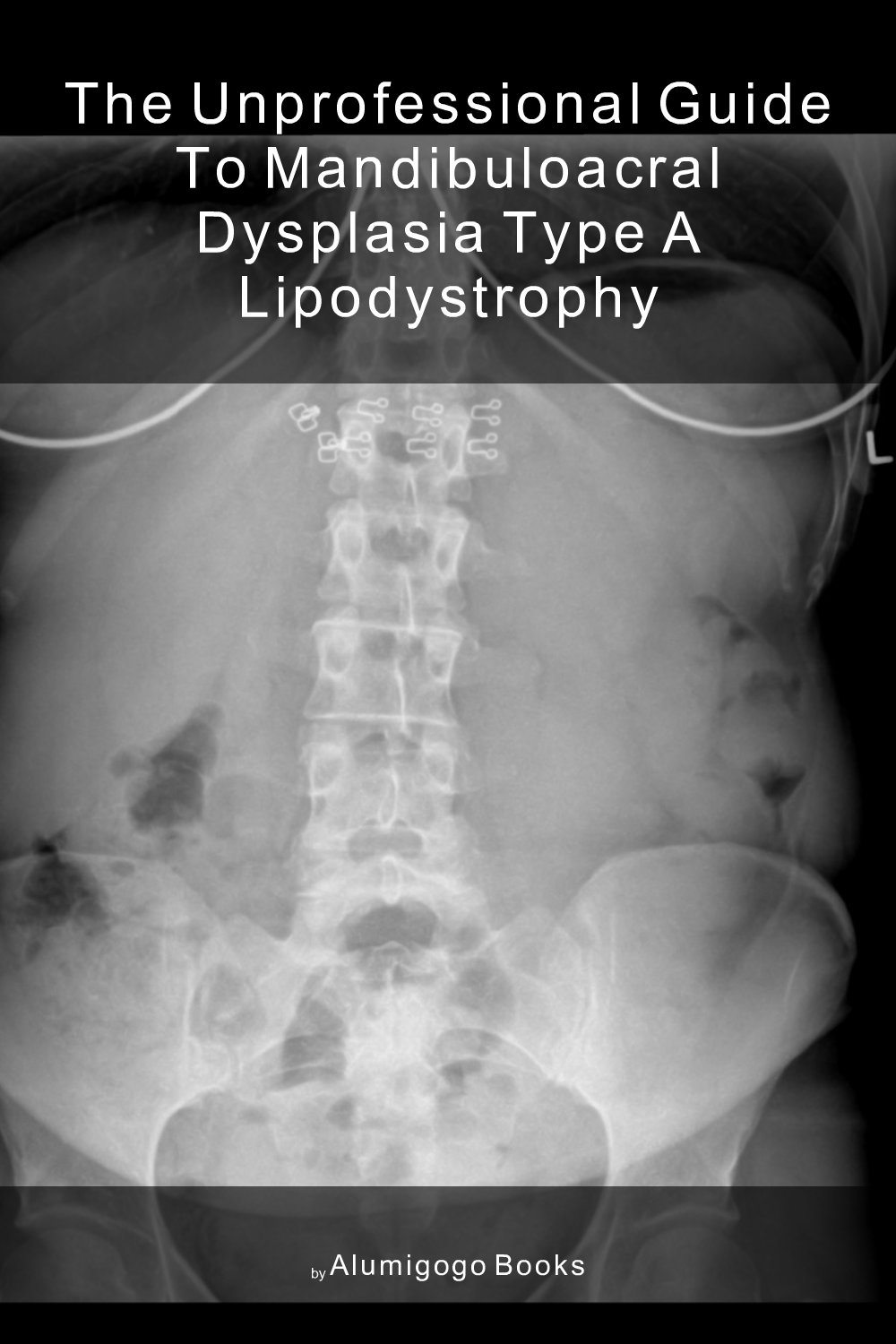 Cover of The Unprofessional Guide to mandibuloacral dysplasia type A lipodystrophy