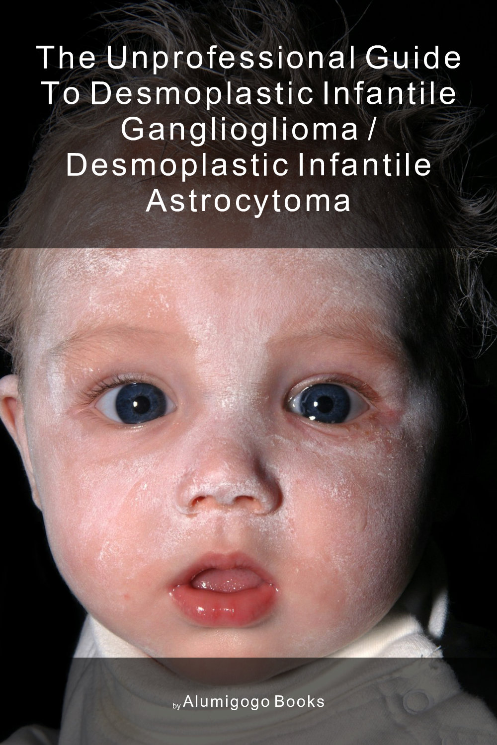 Cover of The Unprofessional Guide to desmoplastic infantile ganglioglioma / desmoplastic infantile astrocytoma