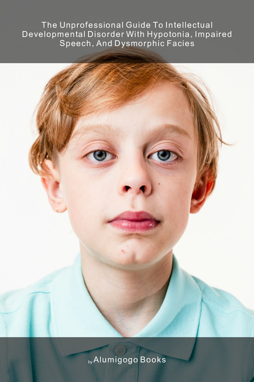 Cover of The Unprofessional Guide to intellectual developmental disorder with hypotonia, impaired speech, and dysmorphic facies