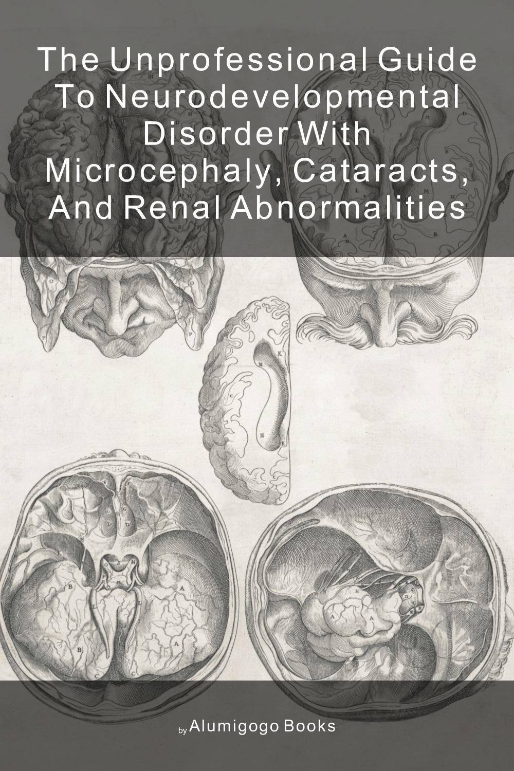 Cover of The Unprofessional Guide to neurodevelopmental disorder with microcephaly, cataracts, and renal abnormalities