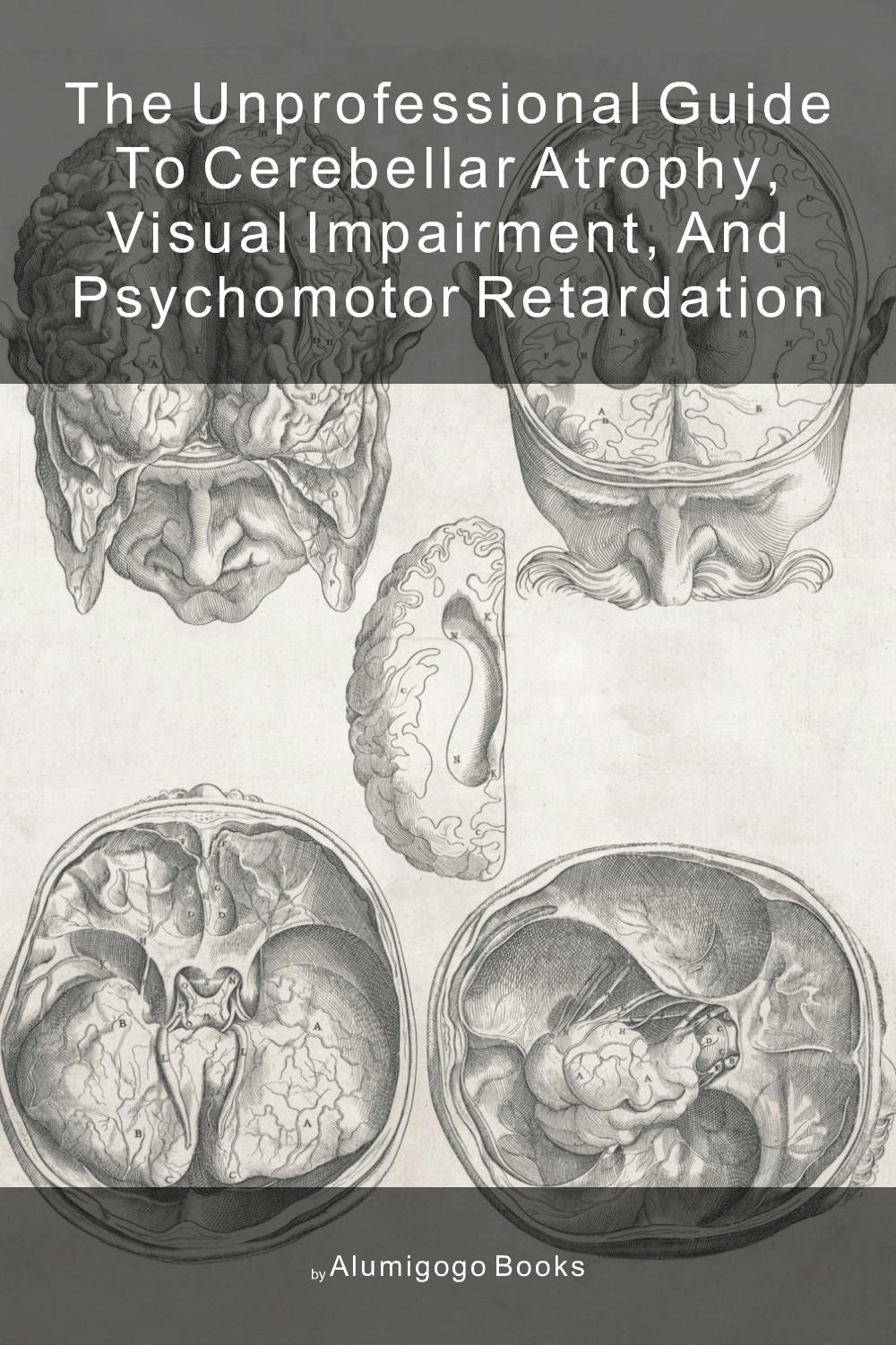 Cover of The Unprofessional Guide to cerebellar atrophy, visual impairment, and psychomotor retardation