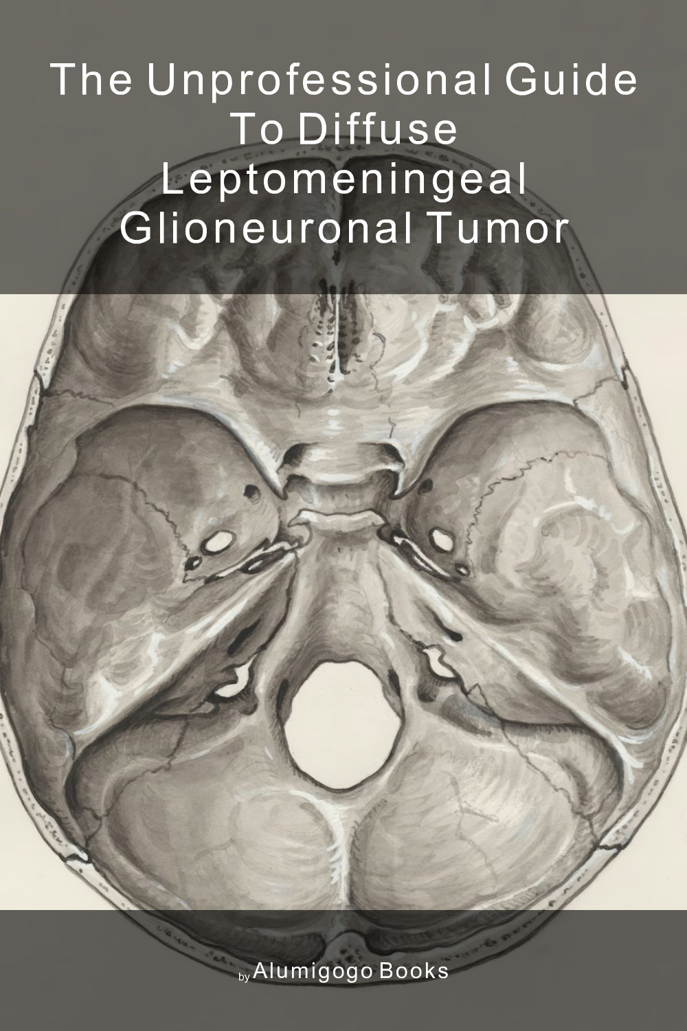 Cover of The Unprofessional Guide to diffuse leptomeningeal glioneuronal tumor