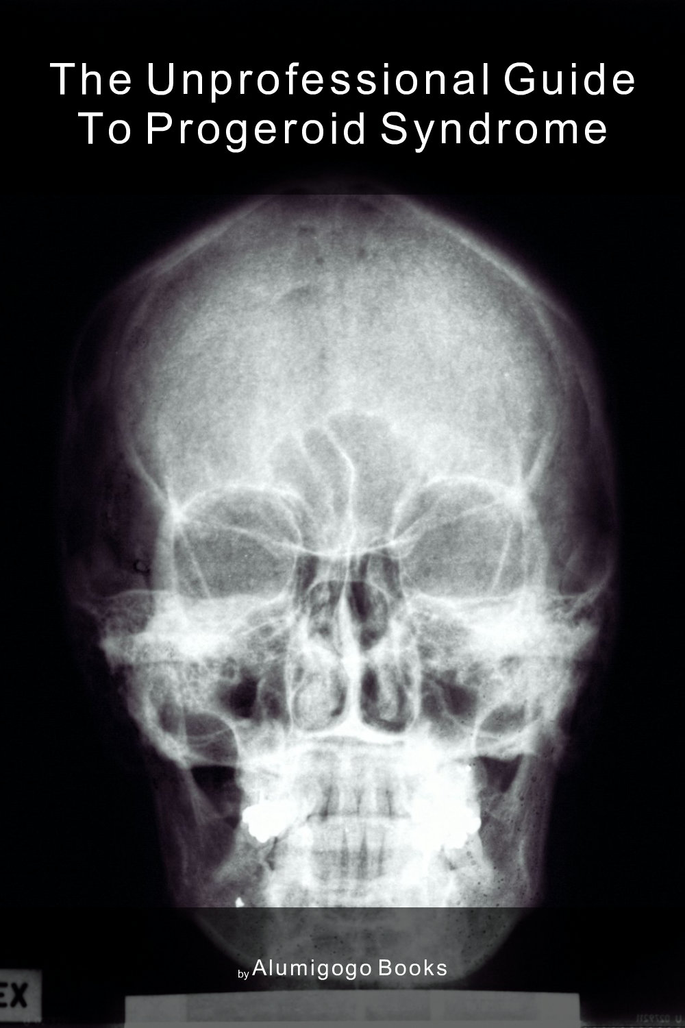 Cover of The Unprofessional Guide to progeroid syndrome