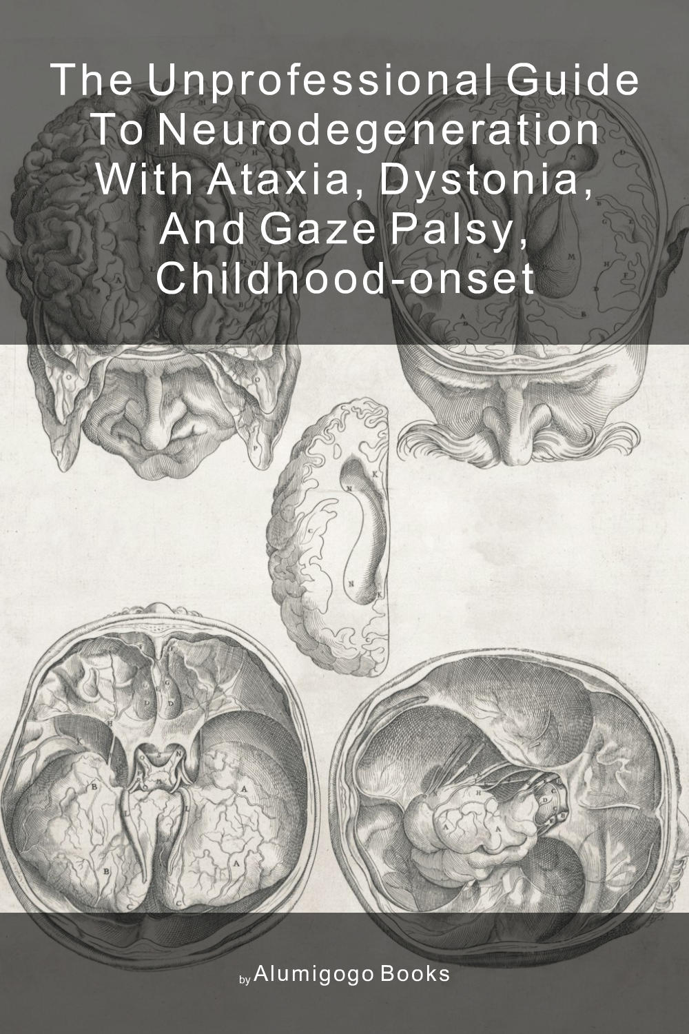 Cover of The Unprofessional Guide to neurodegeneration with ataxia, dystonia, and gaze palsy, childhood-onset