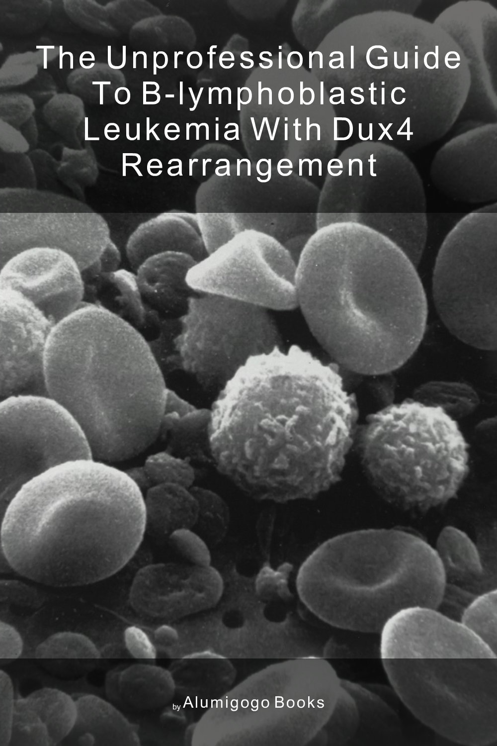 Cover of The Unprofessional Guide to B-lymphoblastic leukemia with DUX4 rearrangement