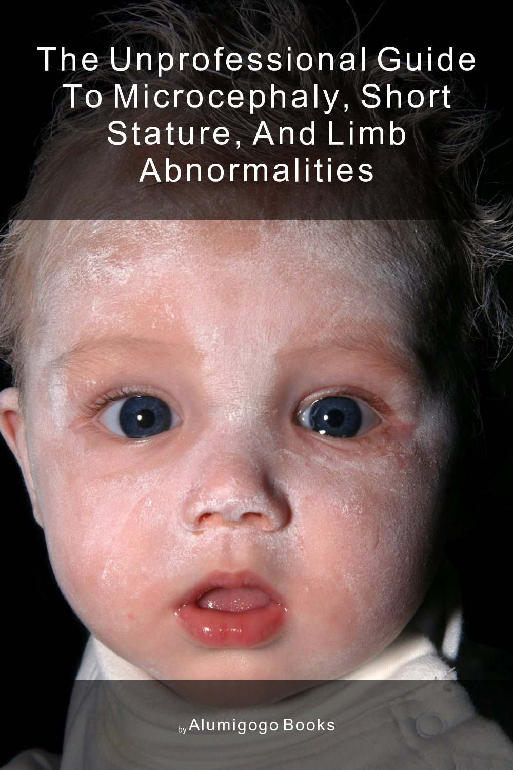 Cover of The Unprofessional Guide to microcephaly, short stature, and limb abnormalities